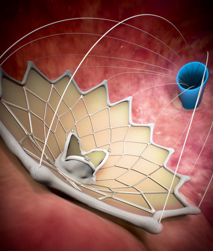 How Your Business Or Medical Practice Can Benefit From Medical Animation