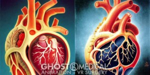 AI generated image of a human heart in the style of Bob Byerley