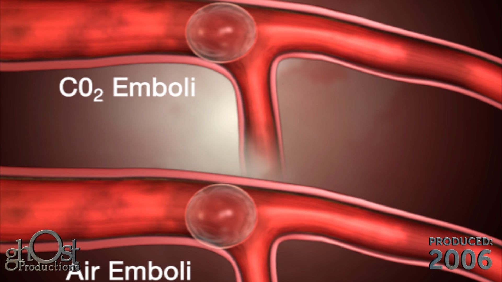 HeartHalo, medical device, animation, mobilization, functionality, CO2 environment, cardiac surgery, Ghost Production, medically accurate, stable CO2 environment, healthcare professionals, patients, benefits, cutting-edge medical technology, search engine results, advancements, cardiac care.