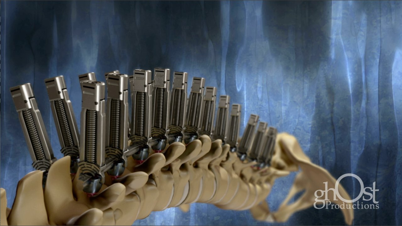 Medical Animation Case Study: K2M Climbers 3 (2013)