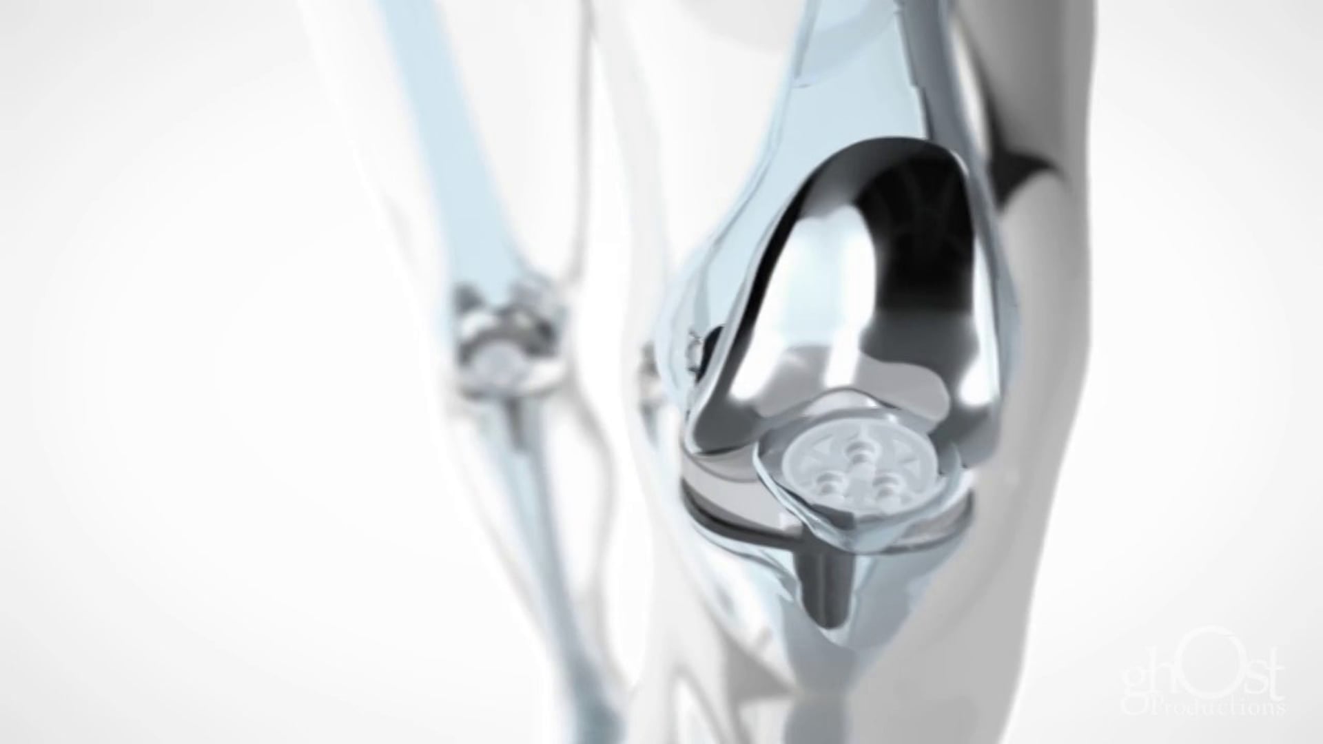 Ghost Medical - Zimmer Global - Knee Glassman Animation