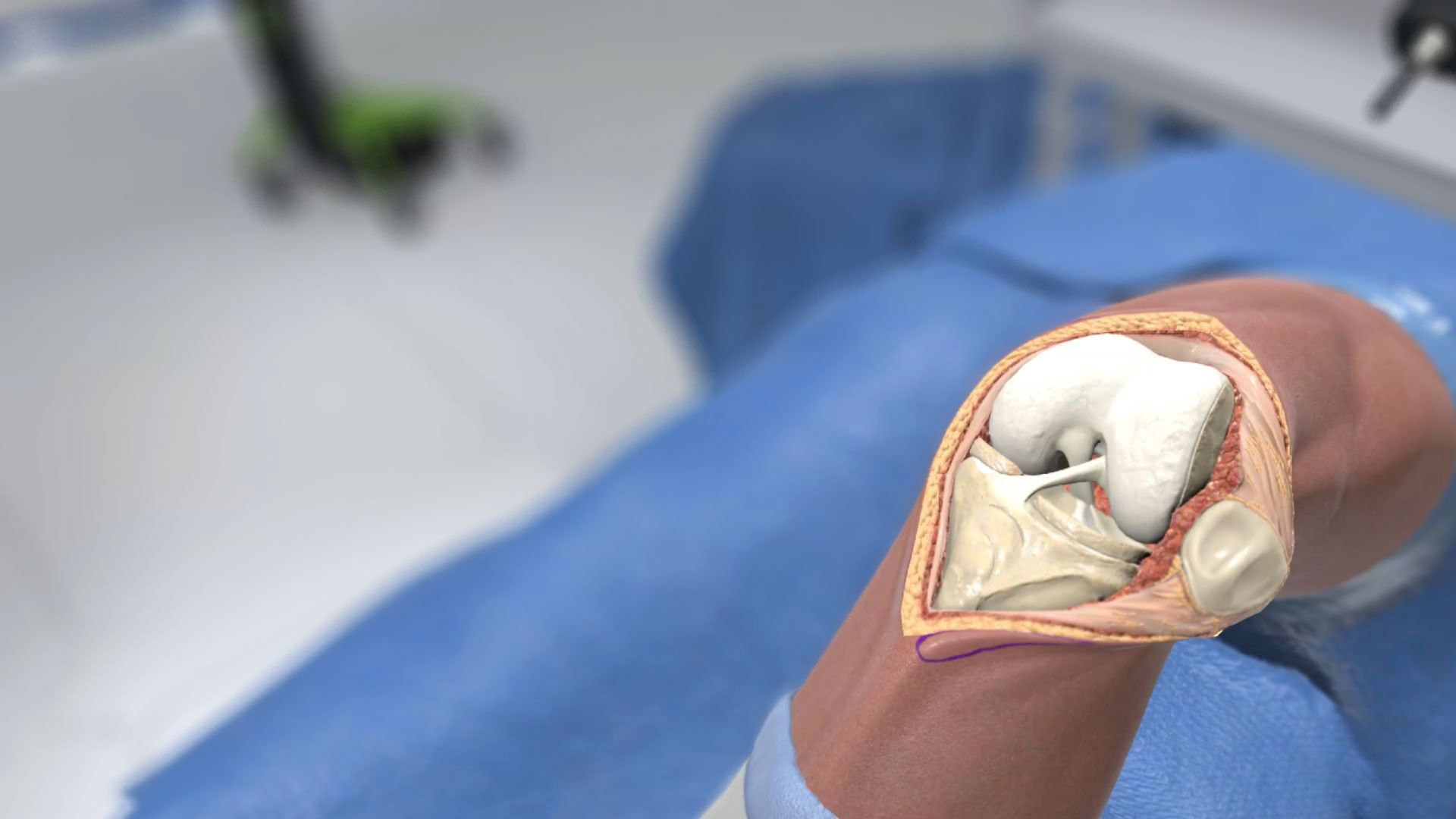 Is The Oculus Quest Powerful Enough to Deliver Portable Surgical Simulations?