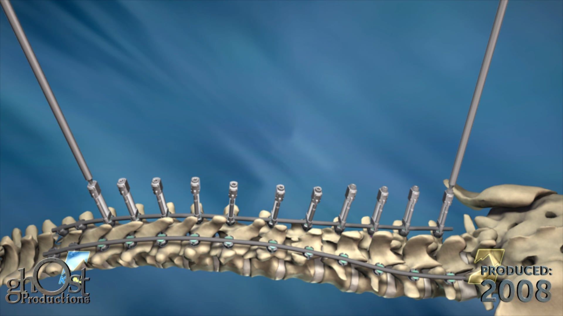 Ghost Medical Presents: The K2M RangeDouble Animation