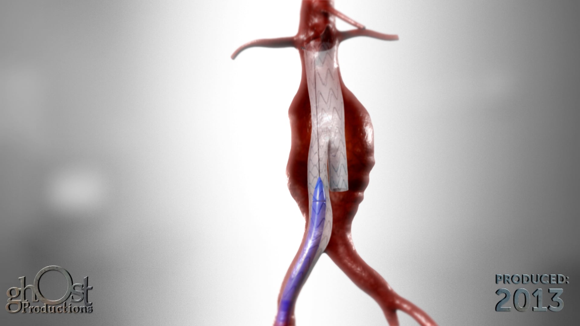 Ghost Medical Presents: Aortic Animation