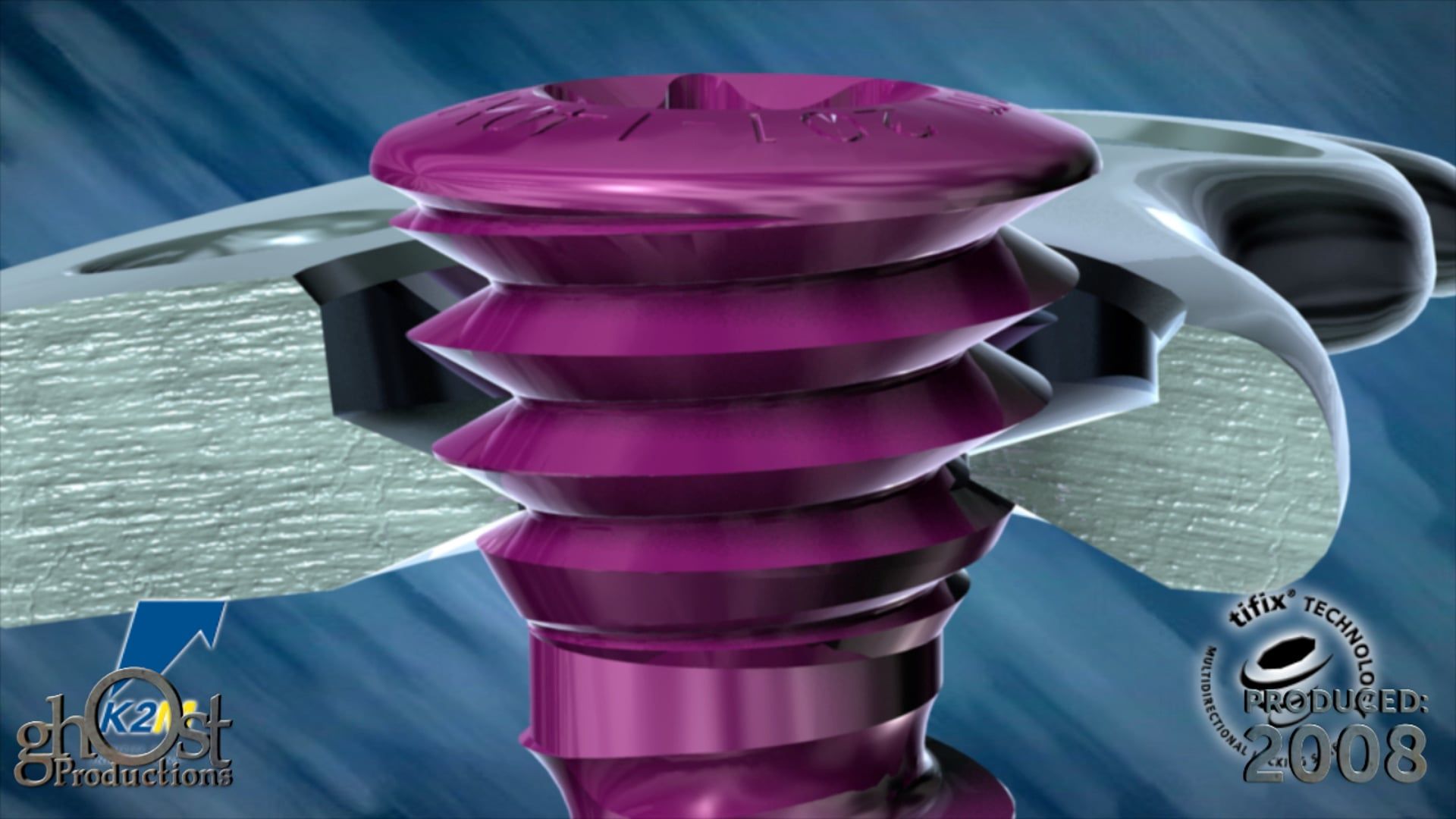 Ghost Medical presents: K2M TiFix - Advanced Spinal Implant Technology
