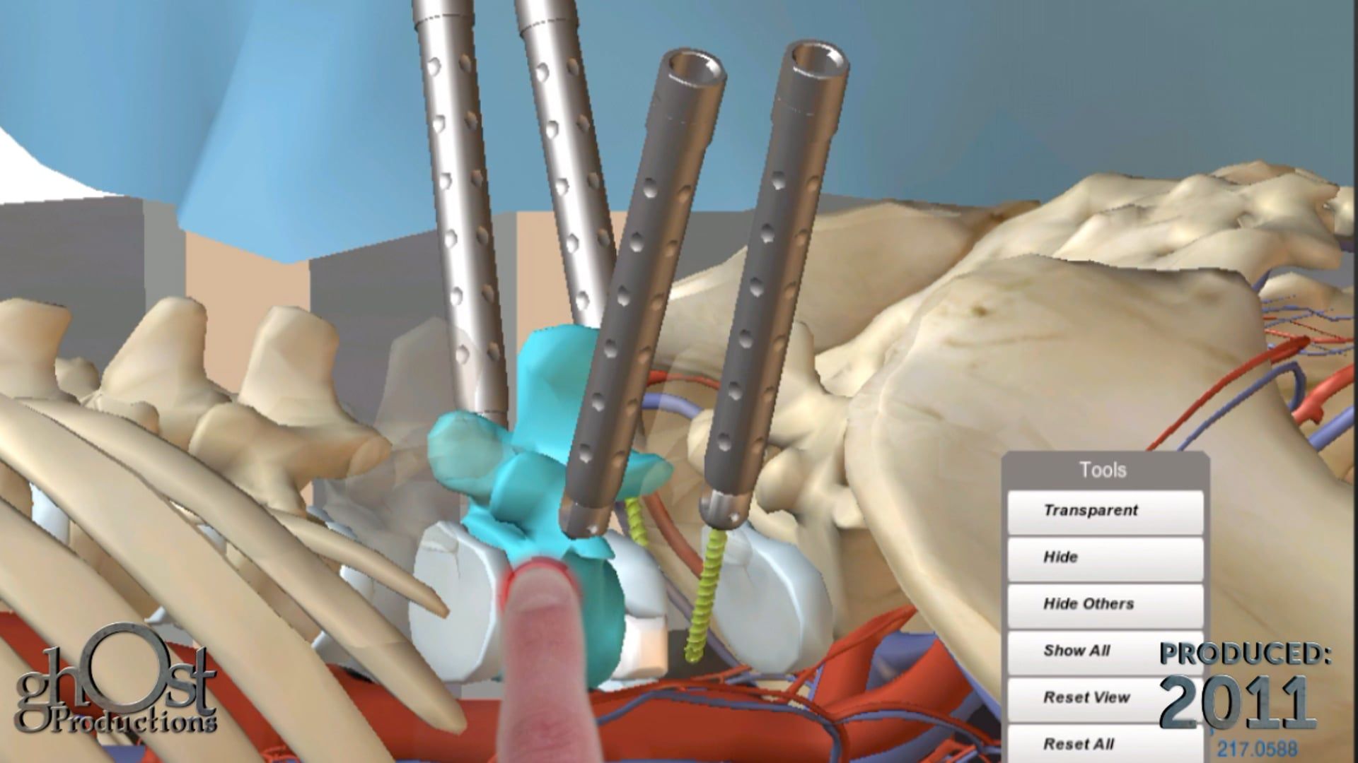 Depuy, medical device company, Ghost Productions, animation, Depuy Spine app, virtual surgery experience, spinal procedures, medical professionals, medical students, risk-free environment, cutting-edge technology, spinal surgery, advancing medicine.