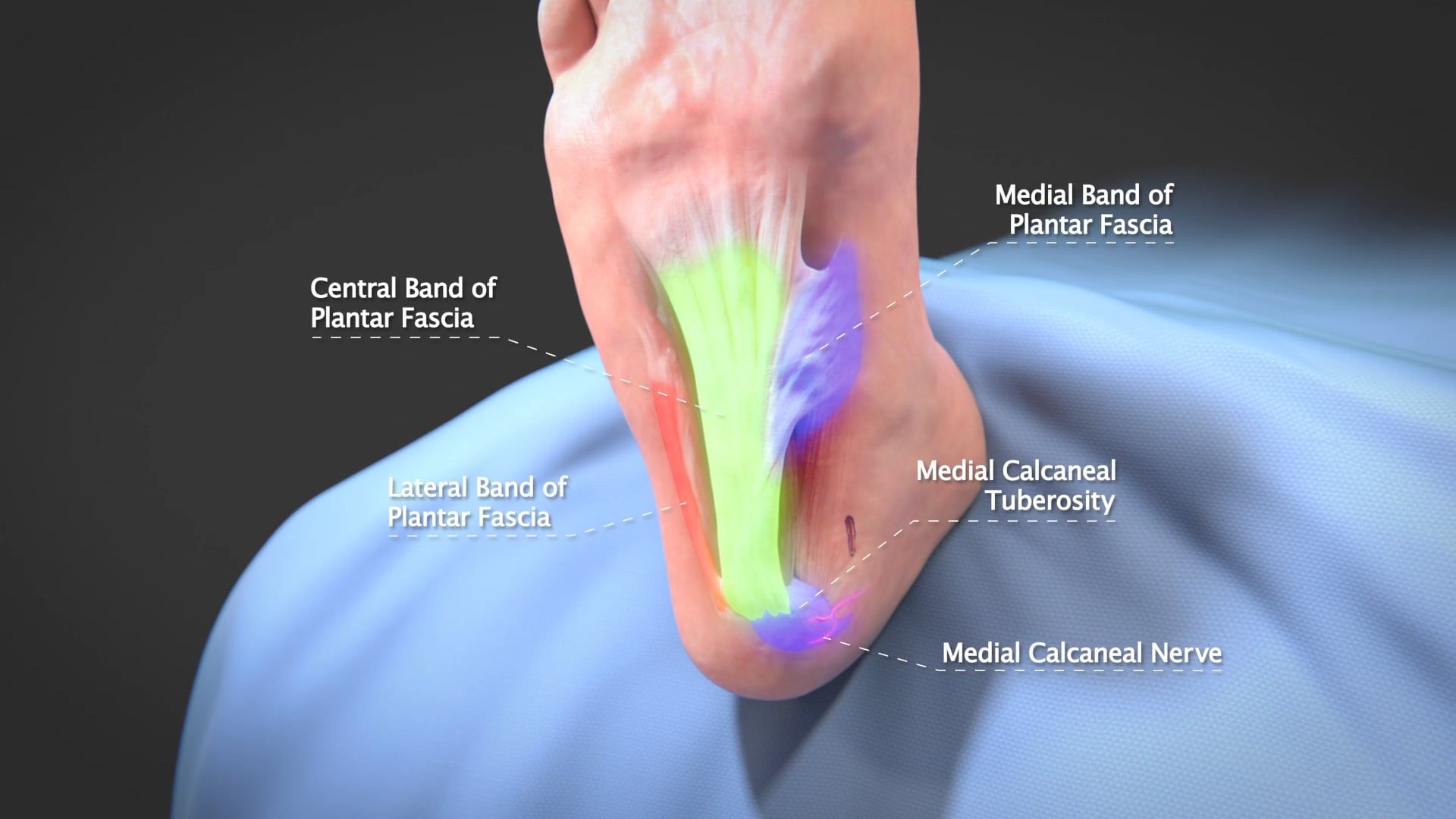 Planter Fascia Release with MicroAire SmartRelease - Ghost Productions