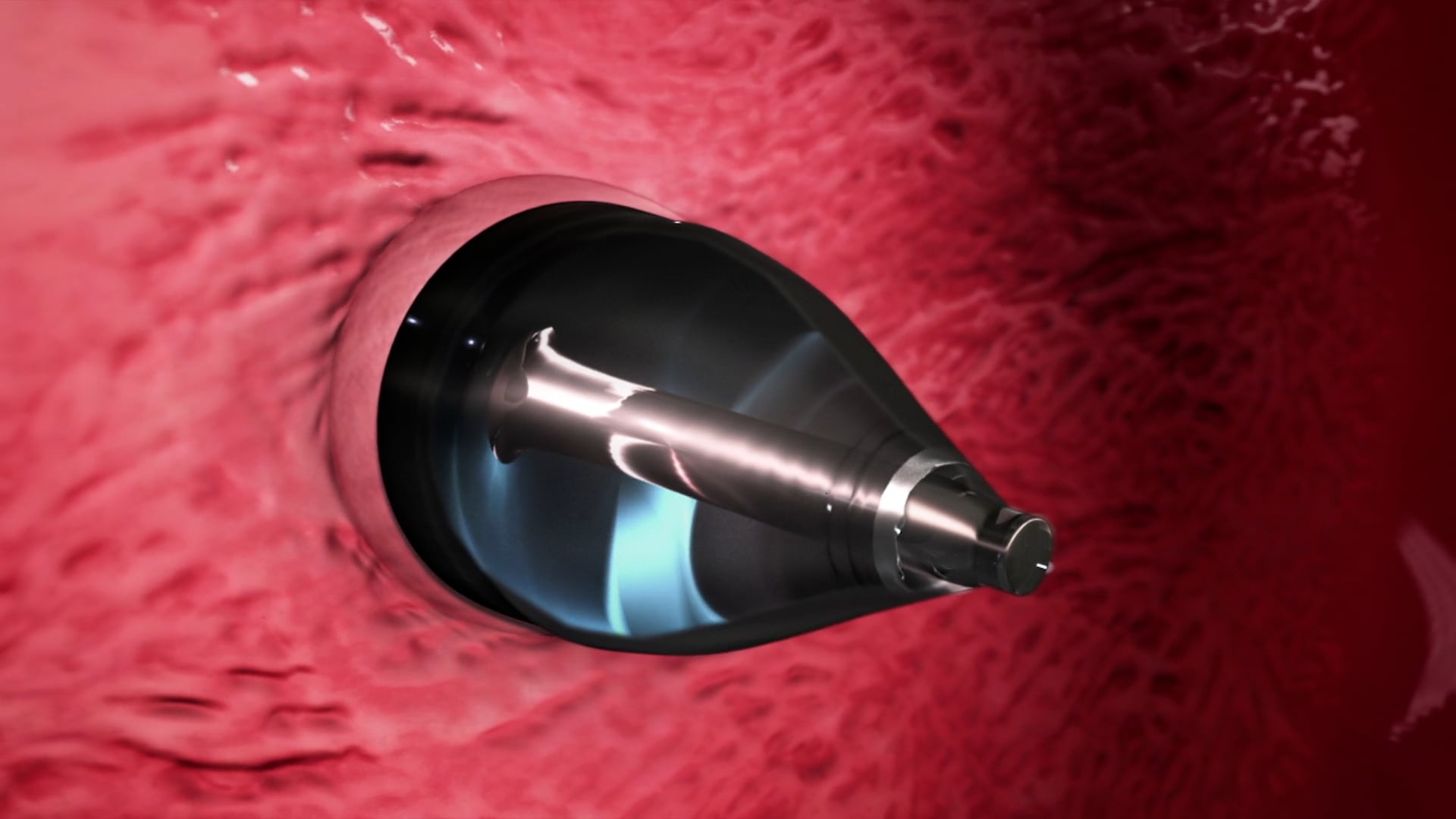 Ghost Medical Presents: Boston Children's - Heart Defects Animation