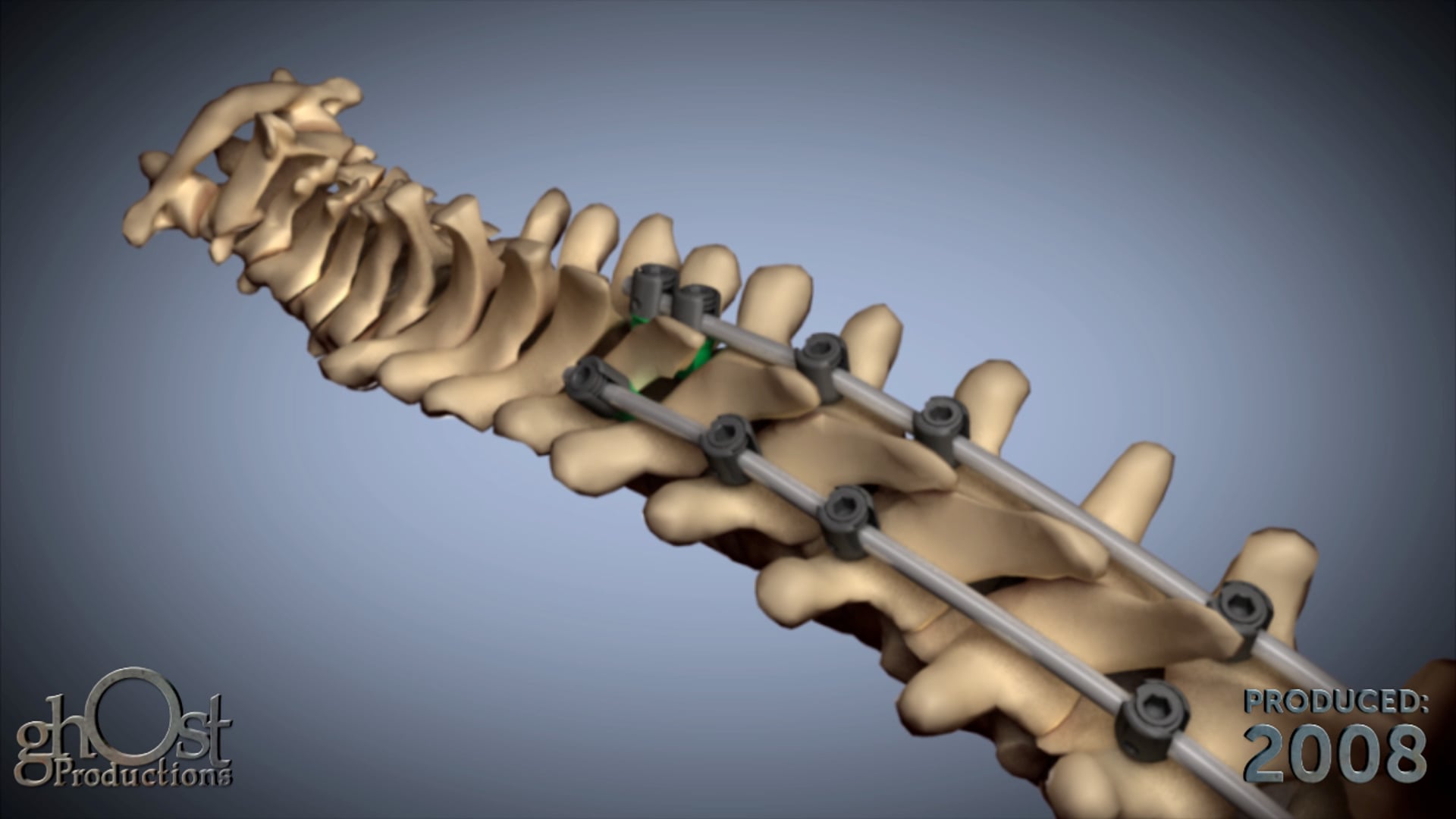 Ghost Medical's US Spine 2008 Animation Reel
