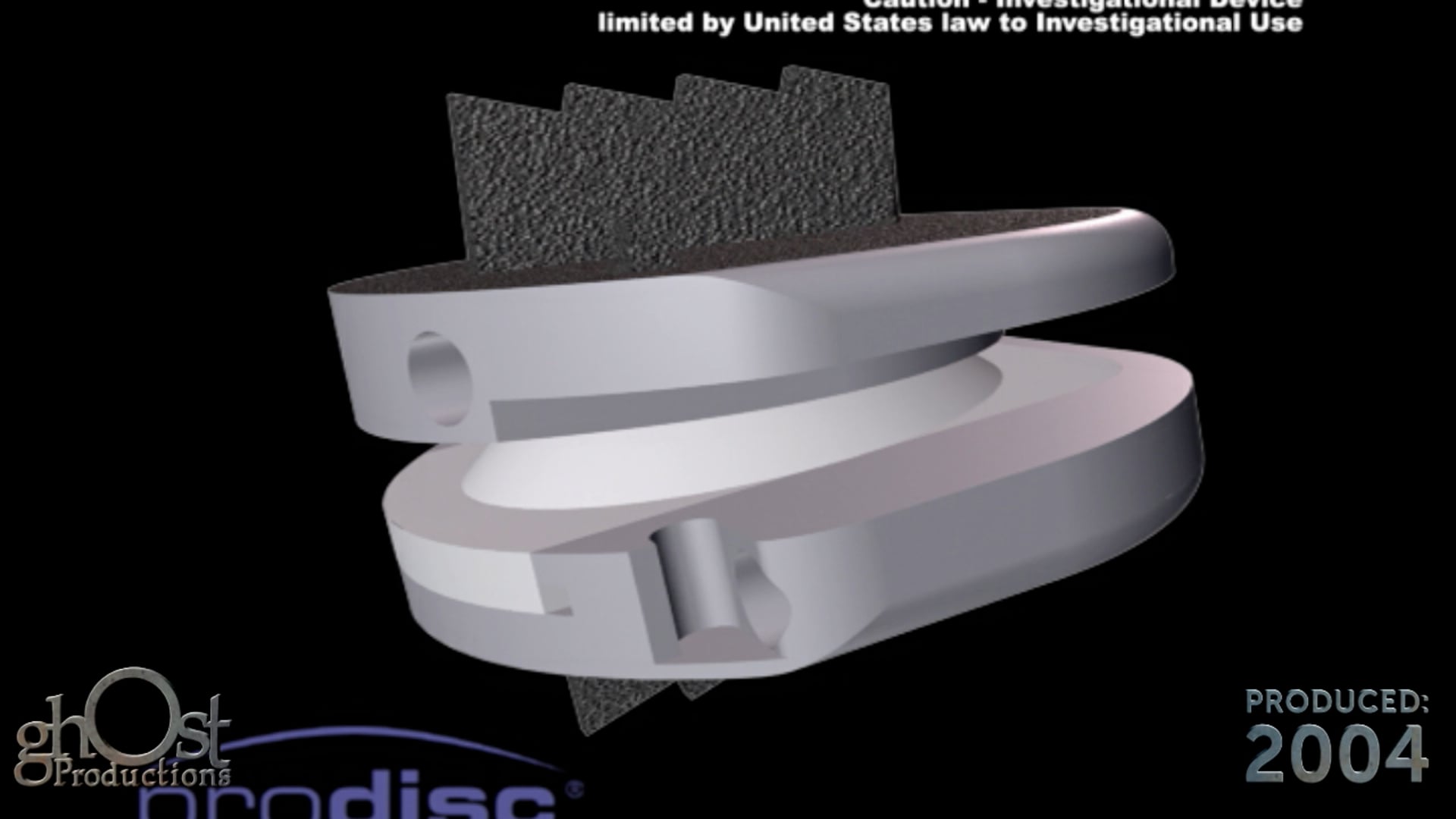 Synthes, ProDisc-C, animation, total disc replacement, cervical spine, disc disease, motion preservation technology, orthopedic medicine, minimally invasive solution, spinal conditions, spinal surgery, Ghost Productions.