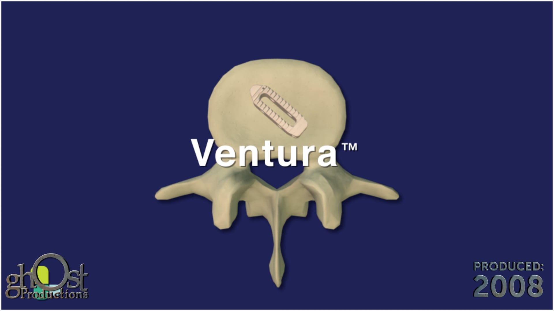 medical animation, spinal implant disc, TLIF approach, spinal implants, spinal conditions, Ventura, innovative products, spinal surgery, orthopedic medicine, Ghost Productions