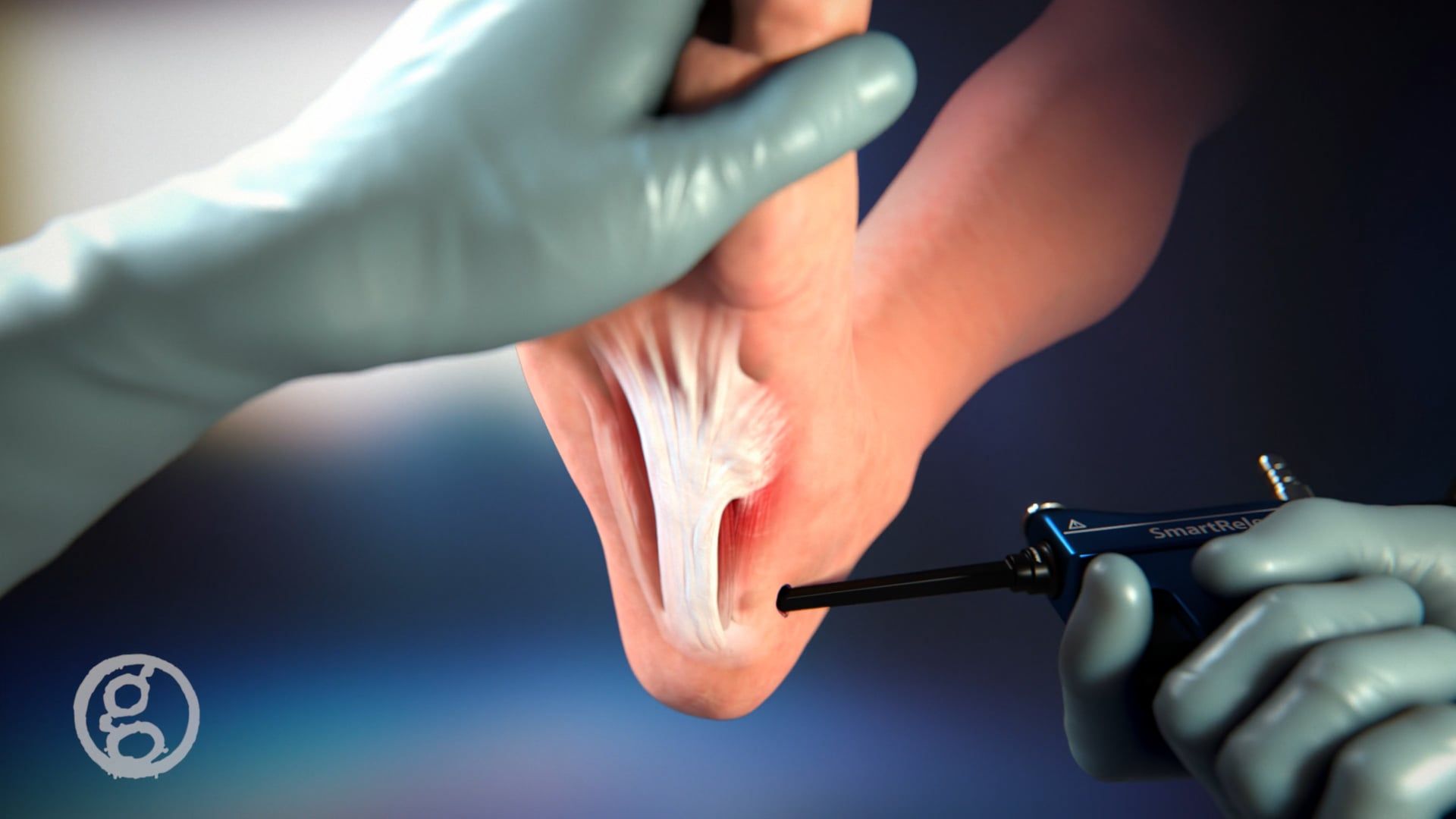 Ghost Productions Medical Animation Demo Reel 2021 | Video