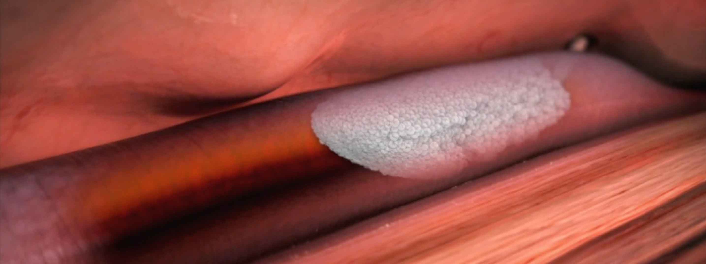 Scleropathy Animation Case Study: DiD Agency