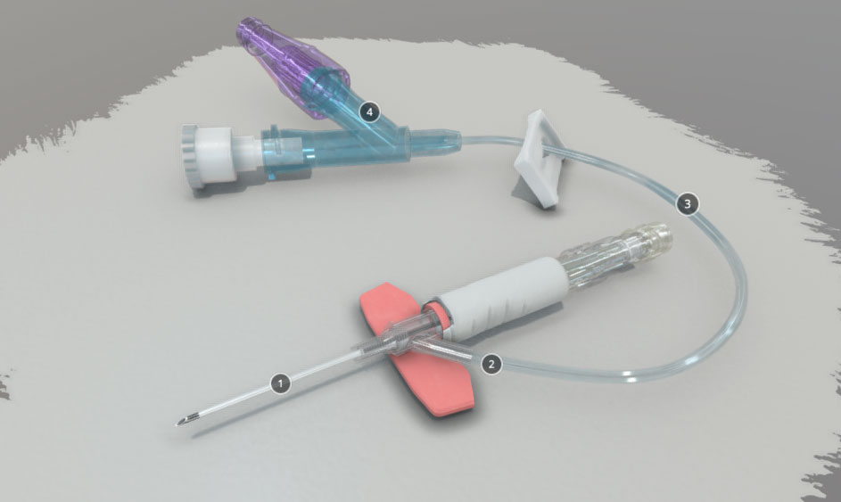 A quick setup to highlight the key features of the Smiths Medical DeltaVen IV catheter can be done in just a few steps. First, the medical professional must ensure that they have all the necessary equipment and supplies on hand, including the DeltaVen IV catheter, a sterile drape, an antiseptic solution, and a syringe or infusion set. They must then prepare the patient's skin by cleaning the insertion site with the antiseptic solution.