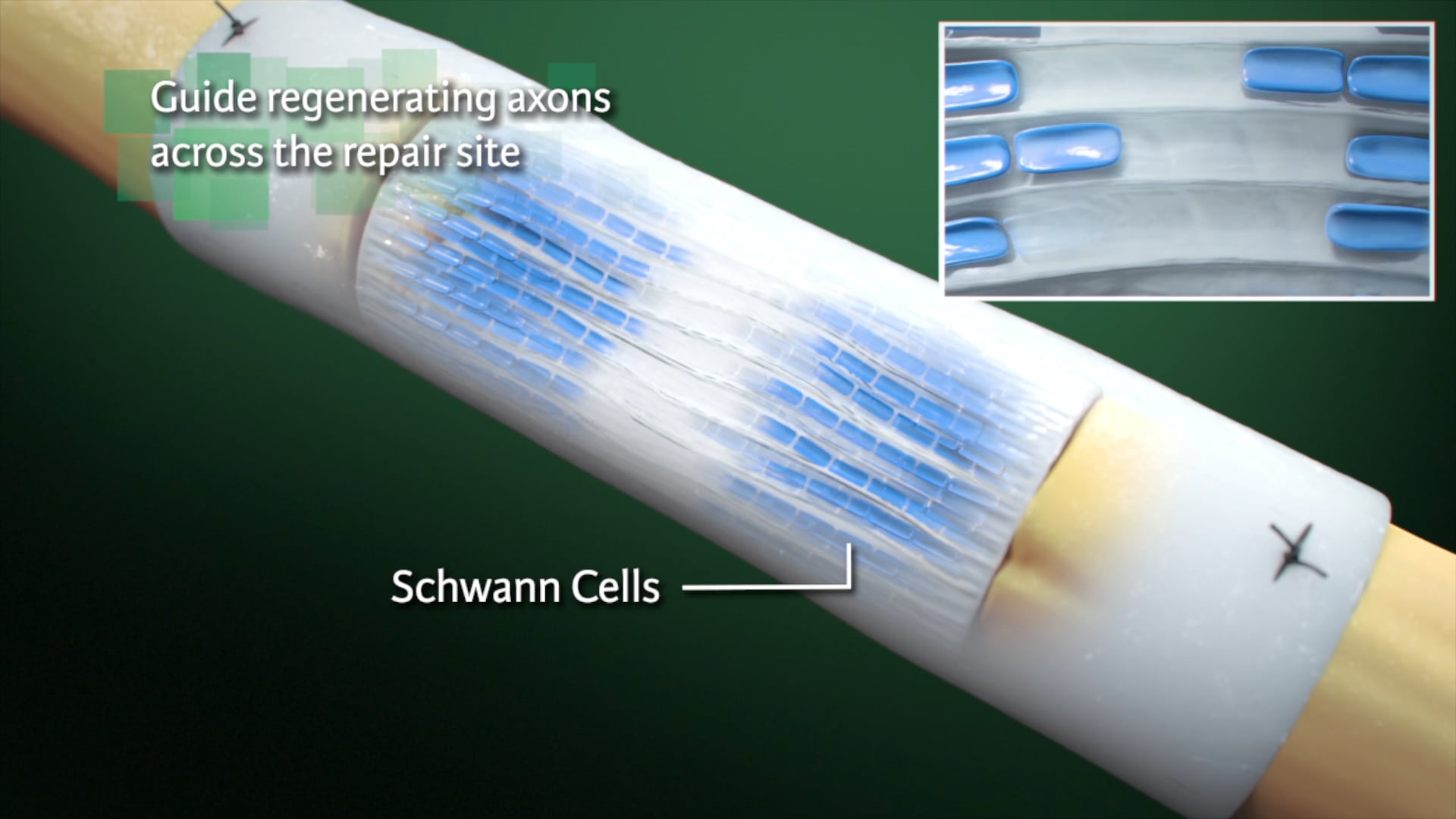 NeuraGen Nerve Guide for Nerve Repair - Ghost Medical