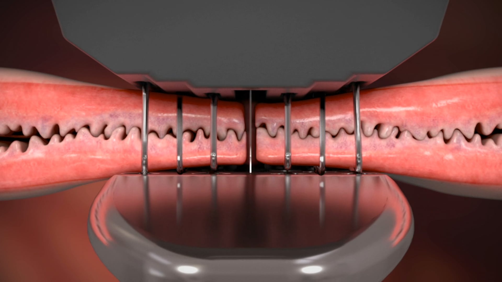 Ghost Medical Presents: Medtronic TriStaple Animation