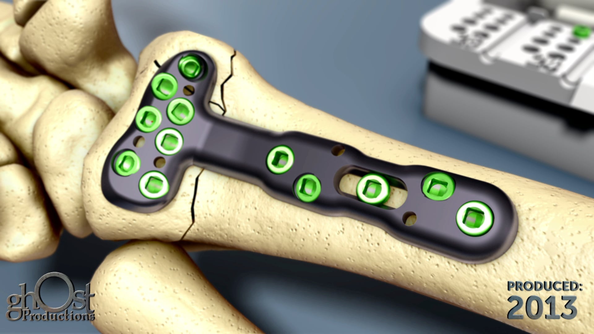 Ghost Medical presents: ePAK DVR Crosslock