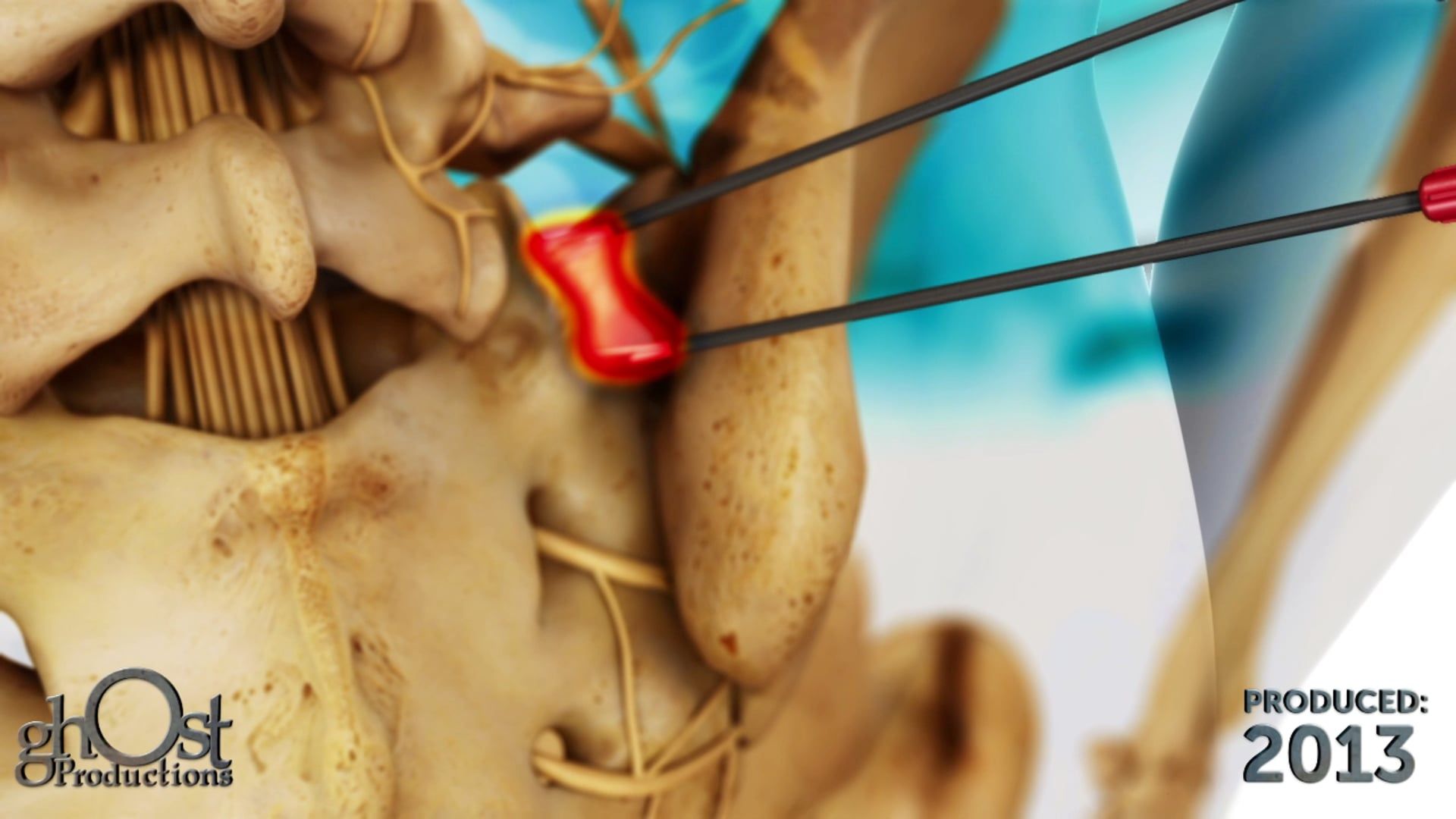 NimbusRF Medical: Enhancing Medical Imaging with Advanced Technology