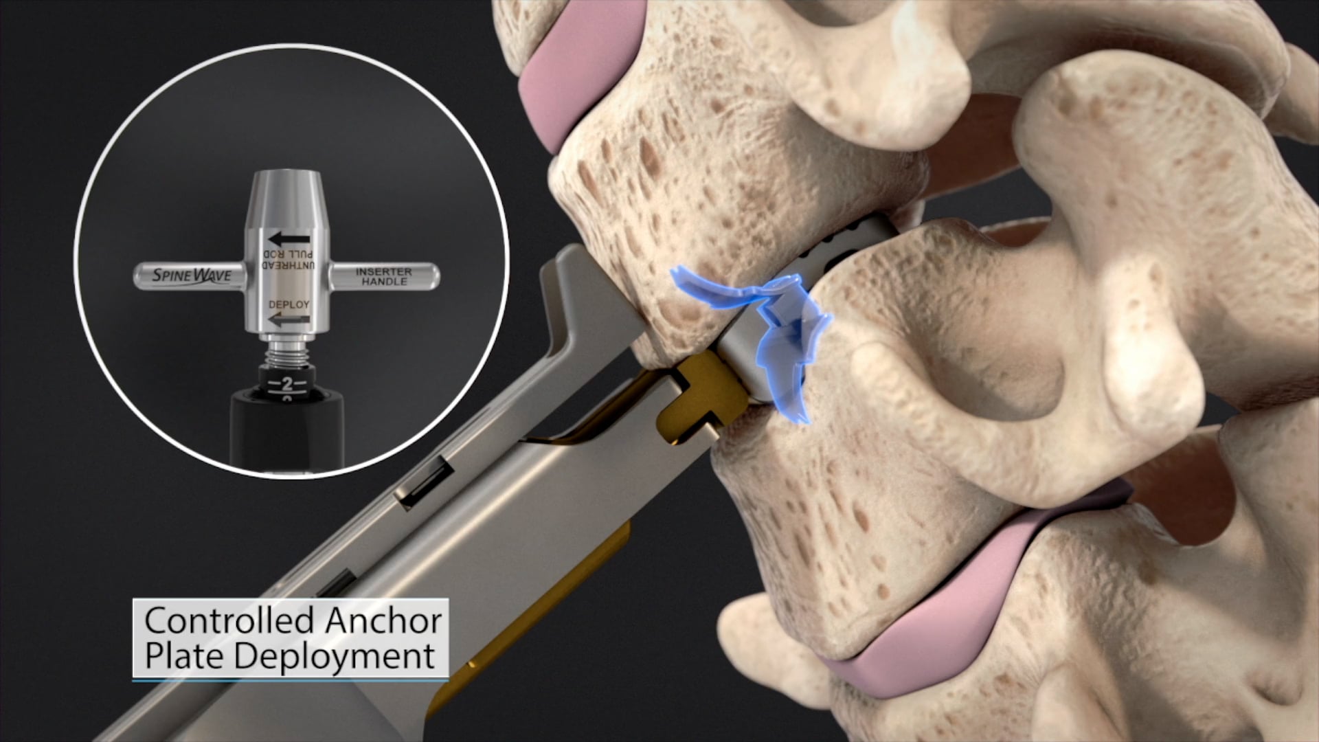 Ghost Medical - Spine Wave Animation - Paramount