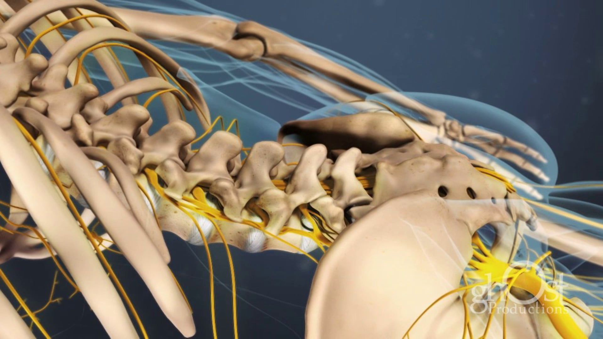 Ghost Medical - Enhancing Spine Health with Epidural Steroid Injection - HD