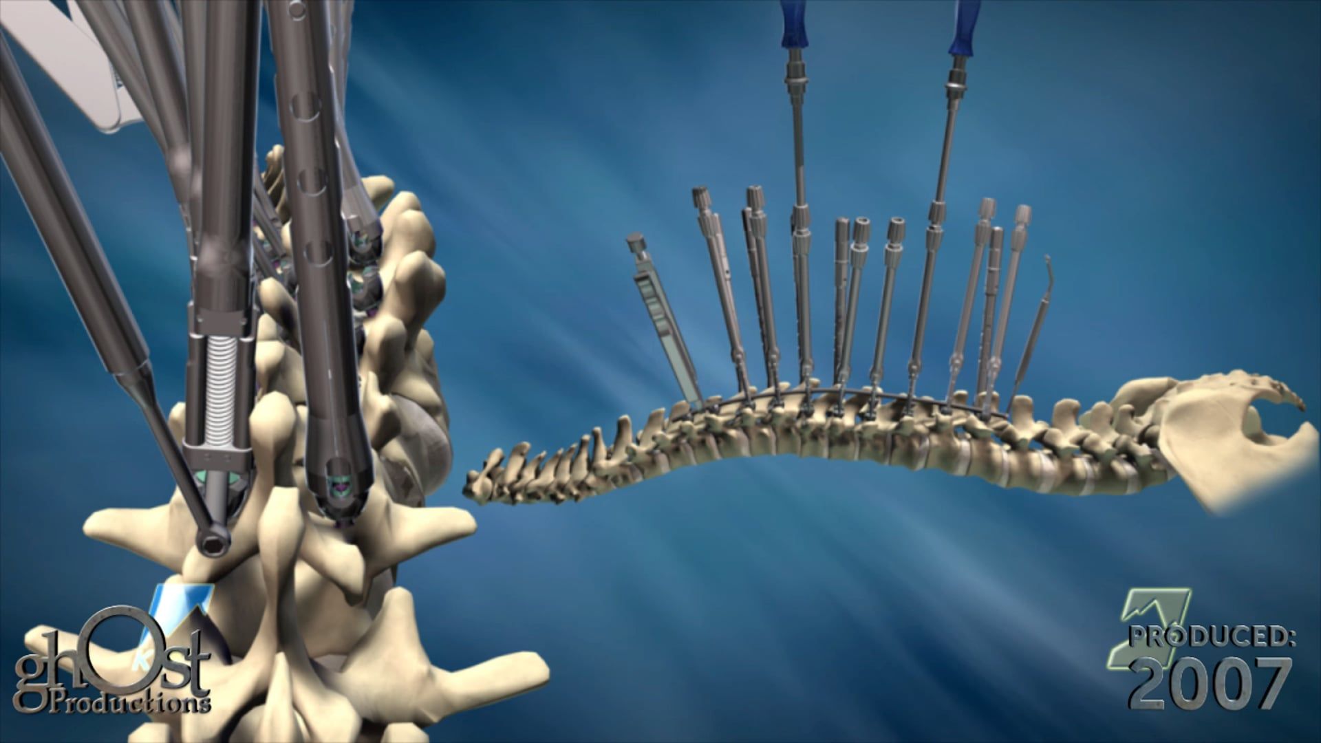 K2M, medical device company, spinal surgery, Ghost Productions, highlight reel animation, product line, 2007 North American Spine Society (NASS) convention, innovative spinal implants, surgical instruments, patient outcomes, surgical complications, precision, safety, trusted by surgeons, worldwide, spinal conditions, advancing the field, best possible care.