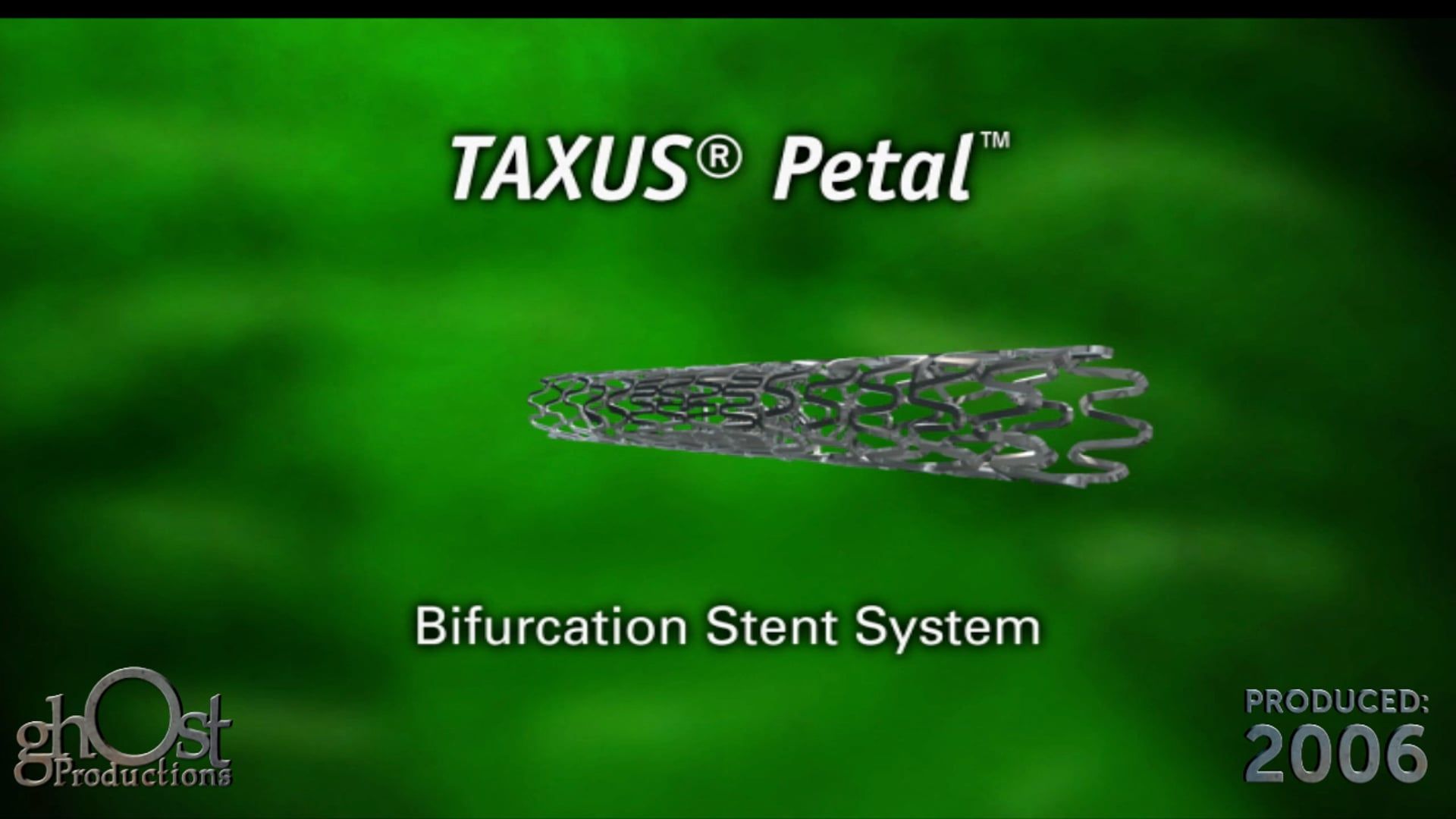 StoneArch, Ghost Productions, Petal device, bifurcation stent system, interventional cardiology, minimally invasive solution, complex coronary artery disease, optimal support, coverage, medically accurate video, latest advancements.