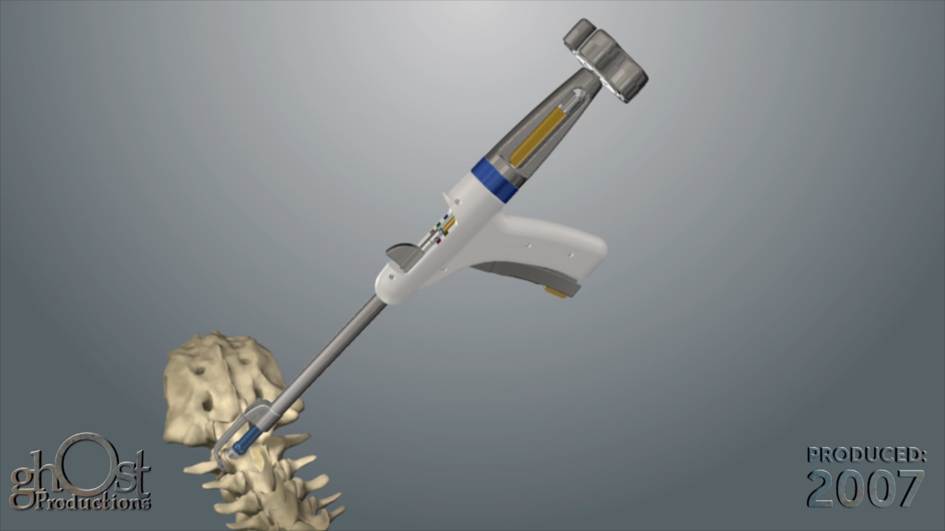 US Spine, medical device company, Ghost Productions, Facet Gun, delivery system, animation, minimally invasive spine surgery, spinal pain, facet joint syndrome, medical professionals, patients, procedure, benefits, innovative product, medical animation.