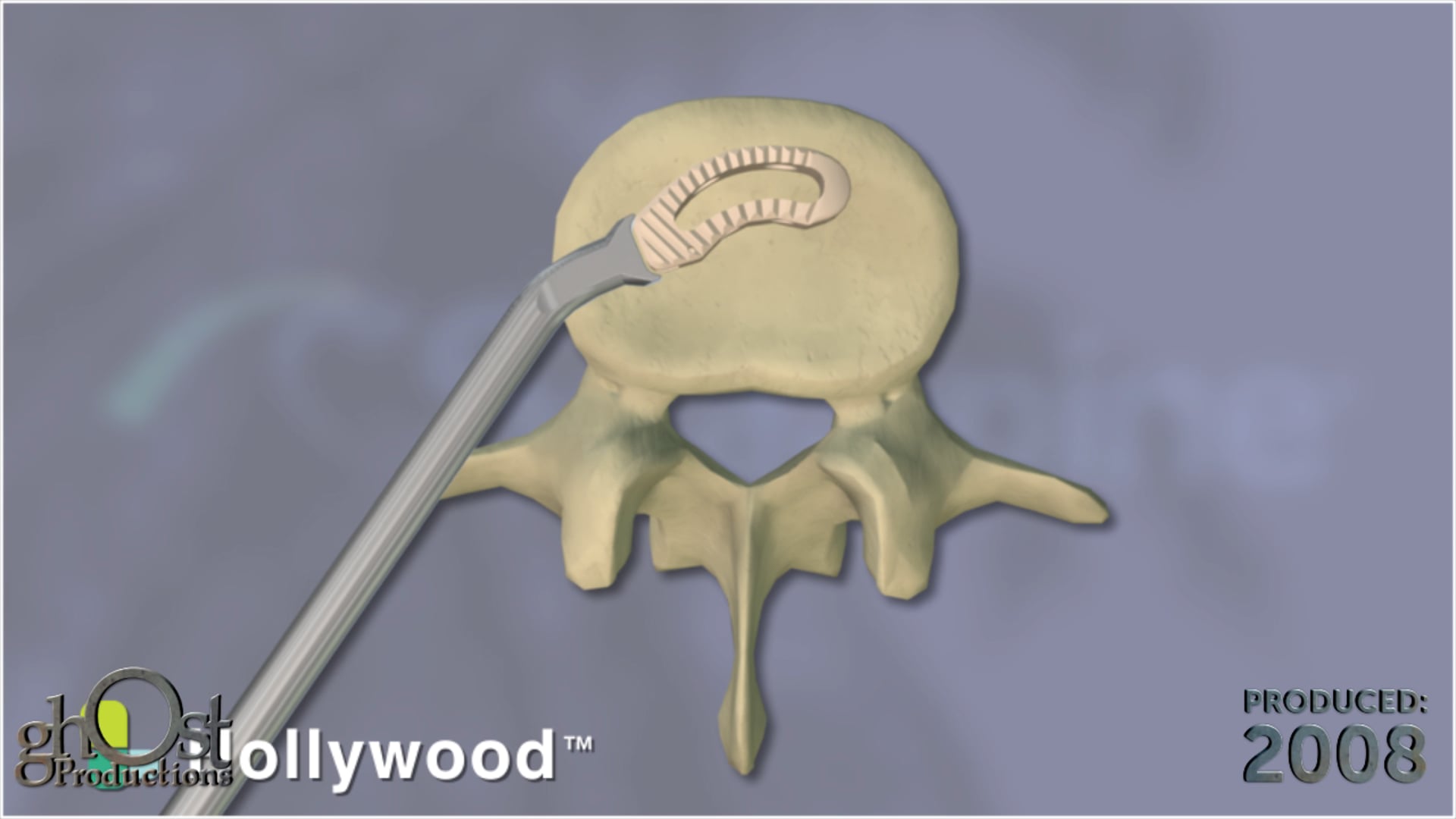 Ghost Medical Presents: SeaSpine Hollywood