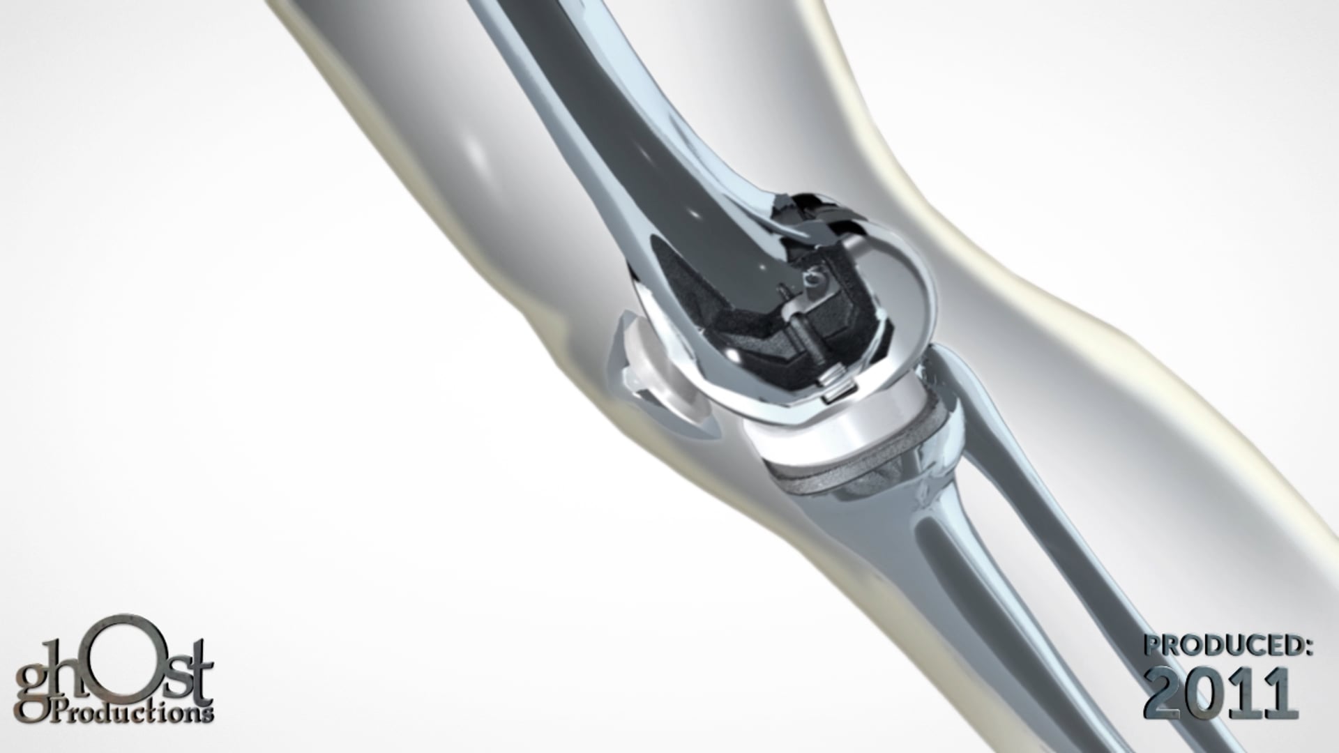Zimmer Global, Ghost Productions, knee implant device, glassman anatomy, orthopedic medicine, innovation, excellence, orthopedic surgery, medical device company, visually stunning animation, implant placement, implant function, knee joint, medically accurate representation, search engine results.
