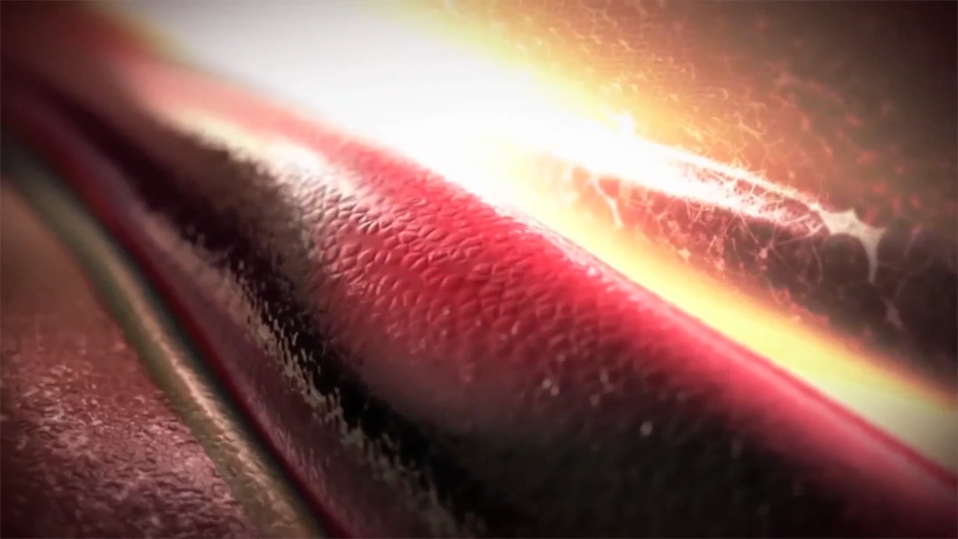 2014 Cardiovascular Demo Reel - Ghost Medical