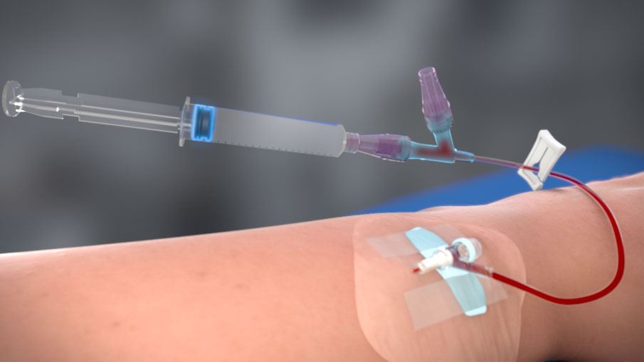 DeltaVen is a multi-lumen CVC, which means that it has multiple channels or lumens within the catheter. This design allows healthcare providers to perform multiple procedures simultaneously, such as administering medications and fluids while also drawing blood for laboratory testing.