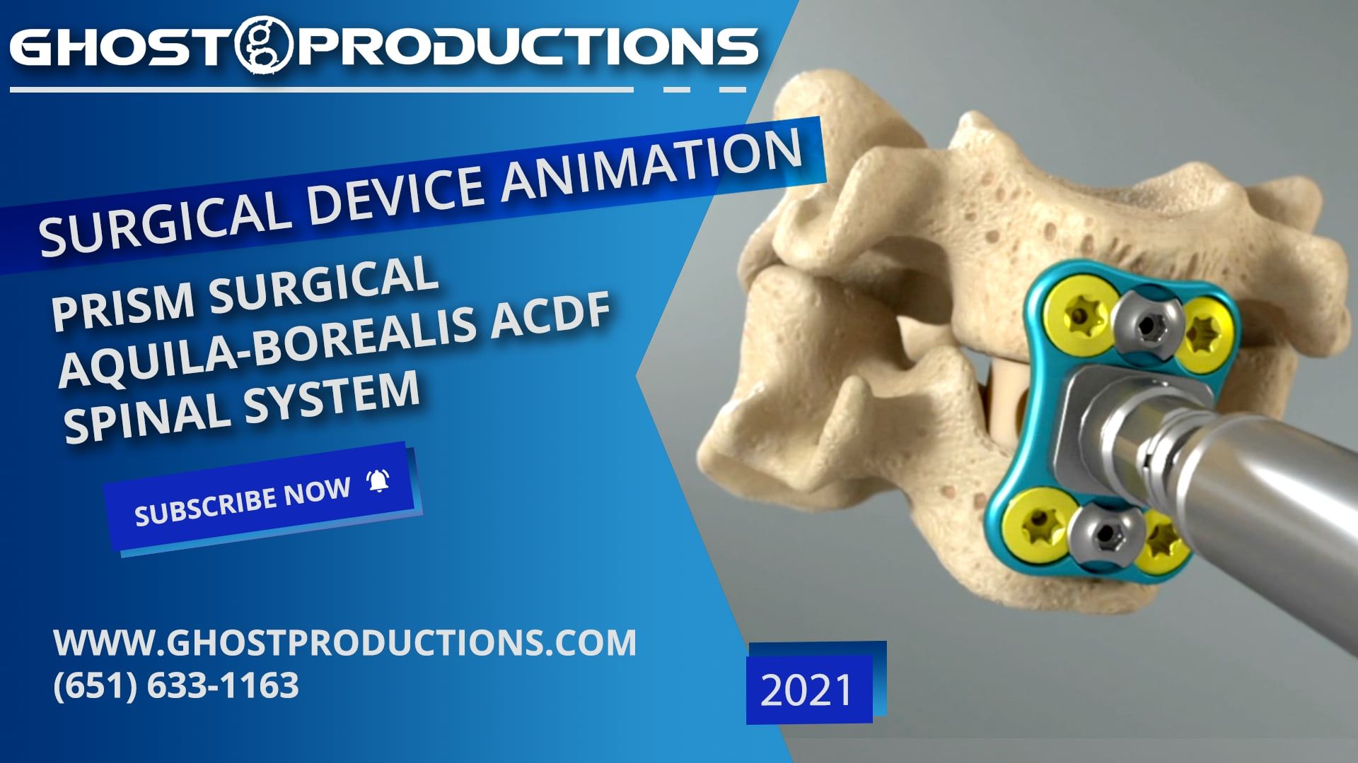 Ghost Medical Animation: Prism Surgical - AQUILA-BOREALIS ACDF Spinal System for Surgical Device