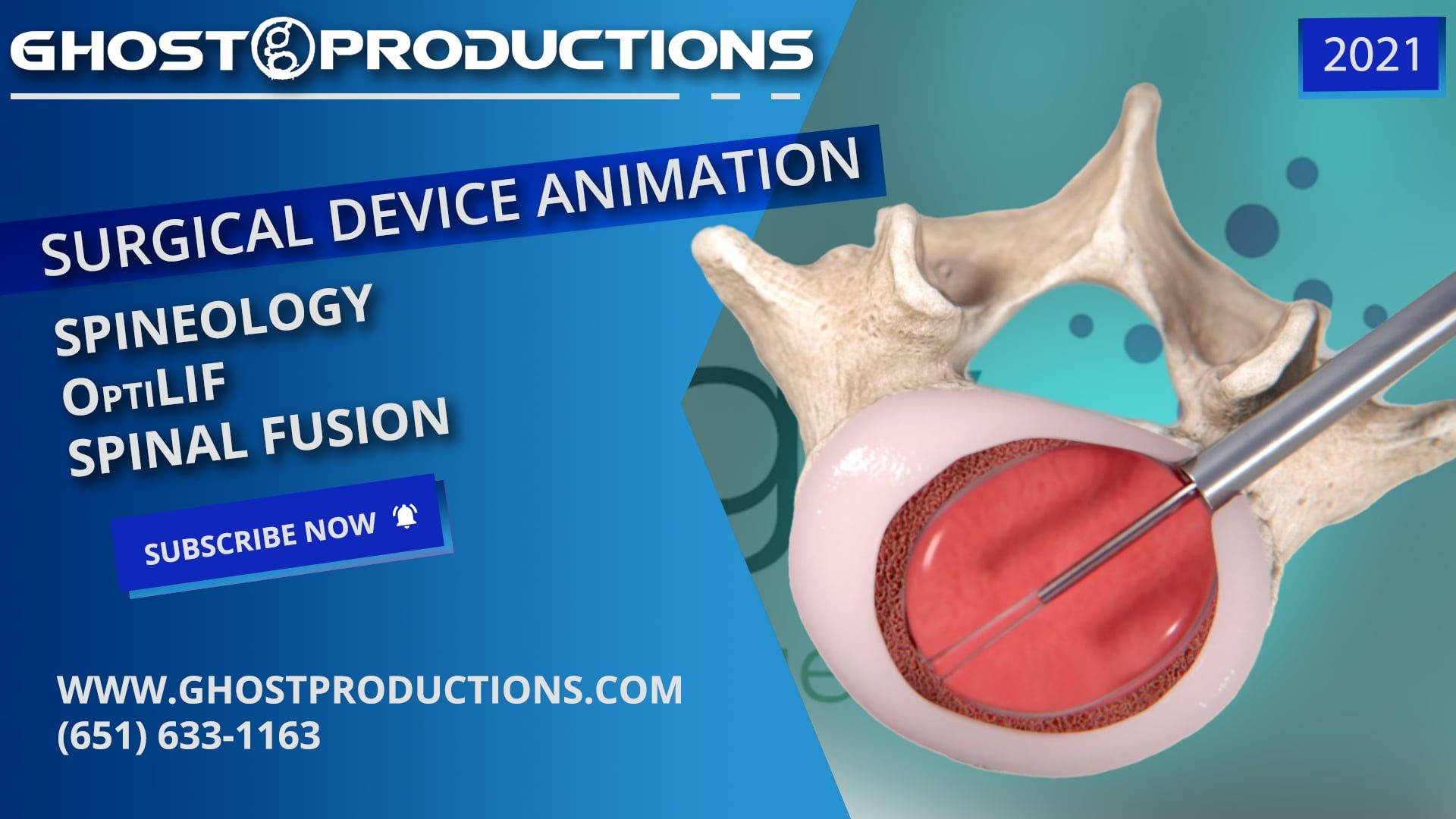 Ghost Productions, medical animation, visually stunning, medically accurate, marketing piece, Spineology, OptiLIF, OptiMesh, Expandable Interbody Fusion System, 3D animated surgical procedure, device's ability, fuse lumbar spine, conserving anatomy, protecting neurology, surgeons, learn, properly use, shorter hospital stays, high patient satisfaction scores, faster recovery times, minimally invasive, fewer pain medications, post-surgery, medical device companies, market products, train surgeons, visually stunning animations, virtual reality experiences, contact, (651) 633-1163.