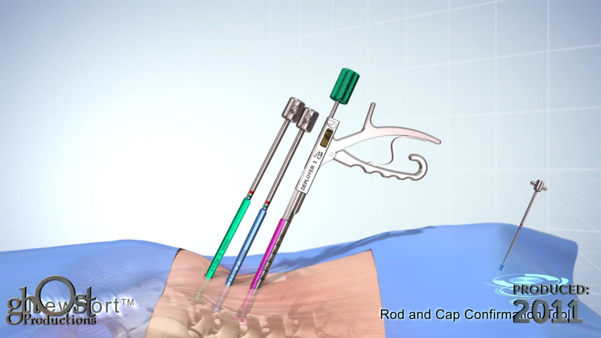 Introducing the SeaSpine NewPort: A Revolutionary Medical Device by Ghost Medical