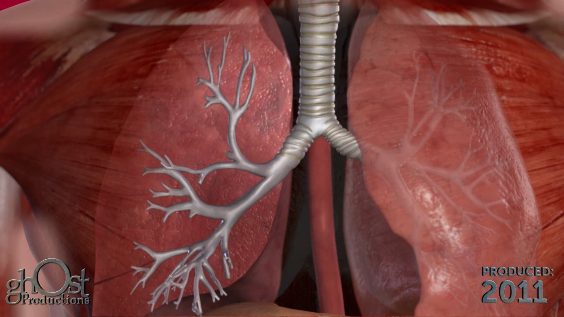 Asthma, informative video, engaging video, stunning animation, Ghost Productions, Mayo Clinic, detailed look, affects the lungs, inflamed bronchial tubes, buildup of mucus, respiratory condition, healthcare professional, common respiratory condition.