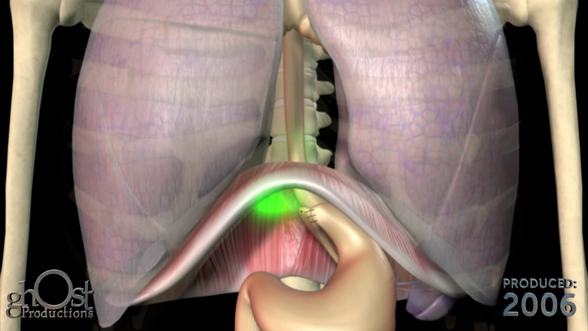 Ghost Medical Presents: Chestnut Cambronne Gauer