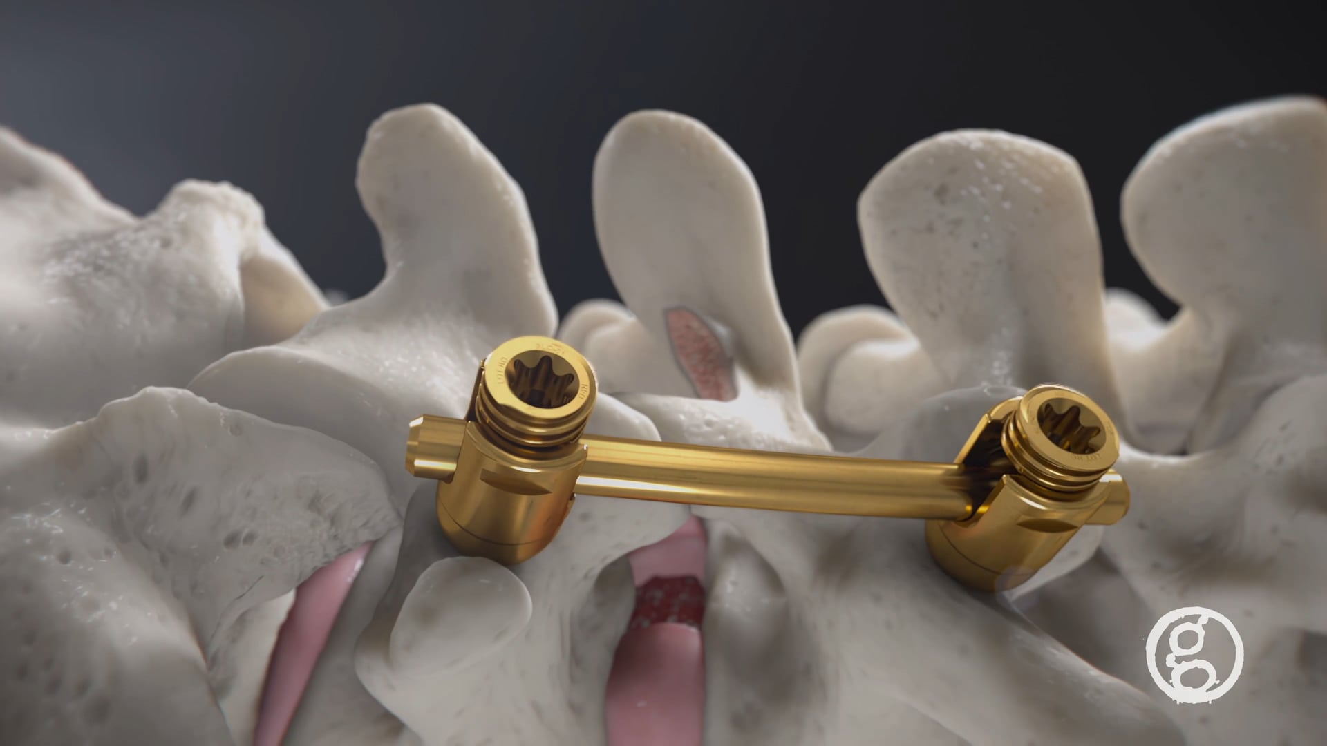 Ghost Medical - Advancements in Orthopaedics - Modera