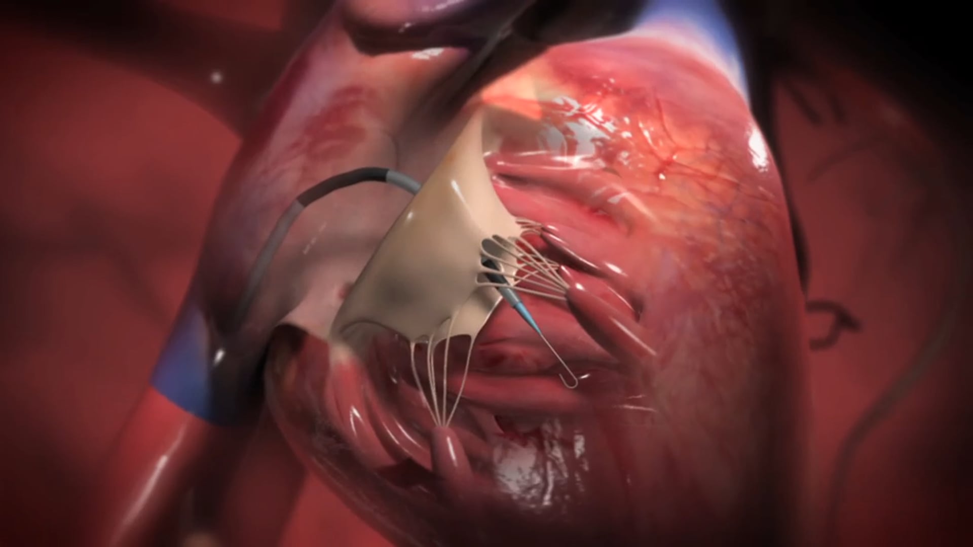 Ghost Medical: MC10 Concept Animation for TED talk