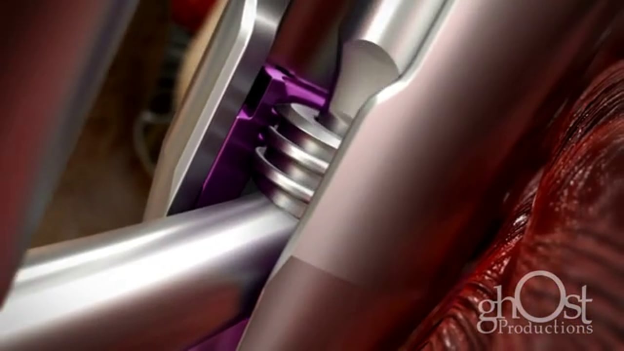 Orthopedics Marketing at AAOS