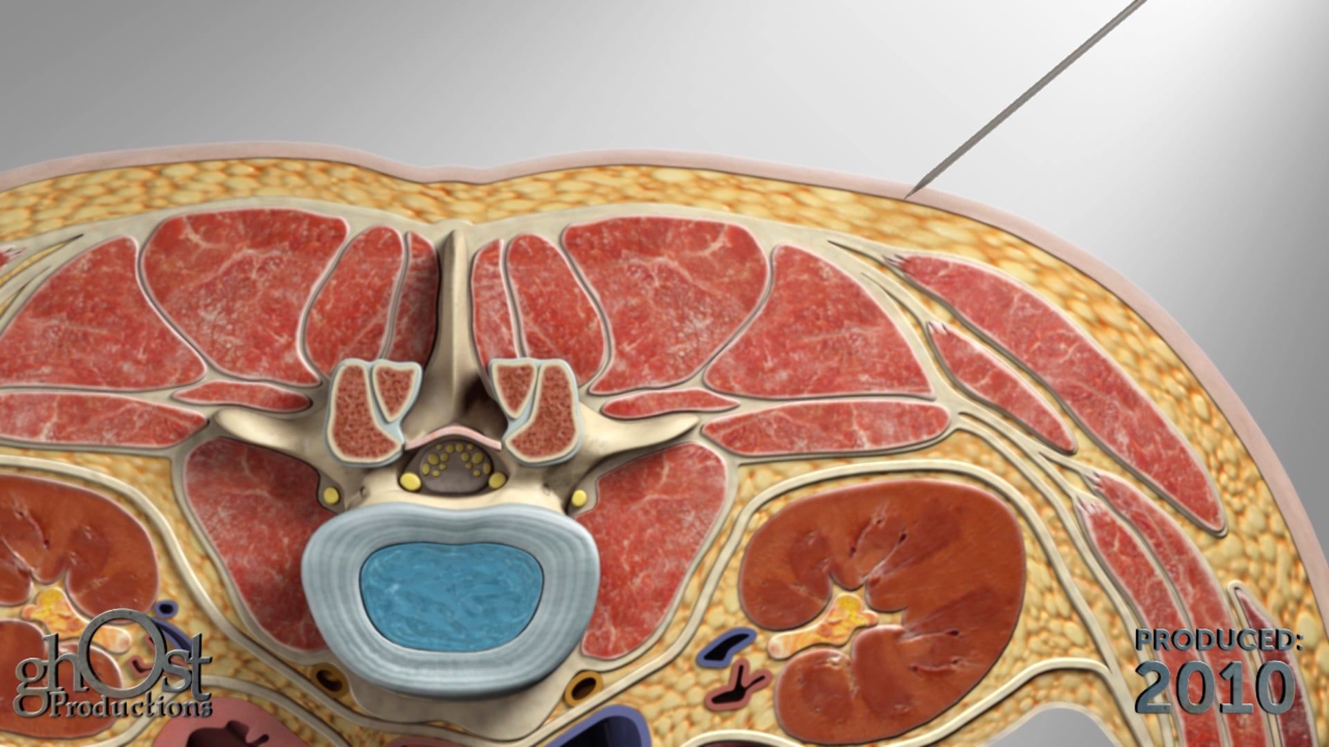 Endoscopic Placement, Medical Animation, Tissue Levels, Nerves, Medical Professionals, Medical Education, Endoscopy, Medical Field, Ghost Production, Medical Accuracy, Visuals, Informative, Engaging, Medical Students, Technology, Medical Understanding.