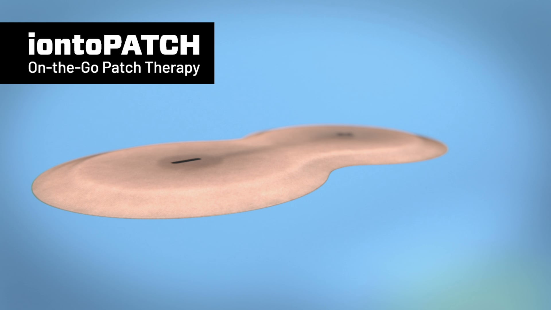 Ghost Medical and Tapemark: A Dynamic Partnership in Medical Animation