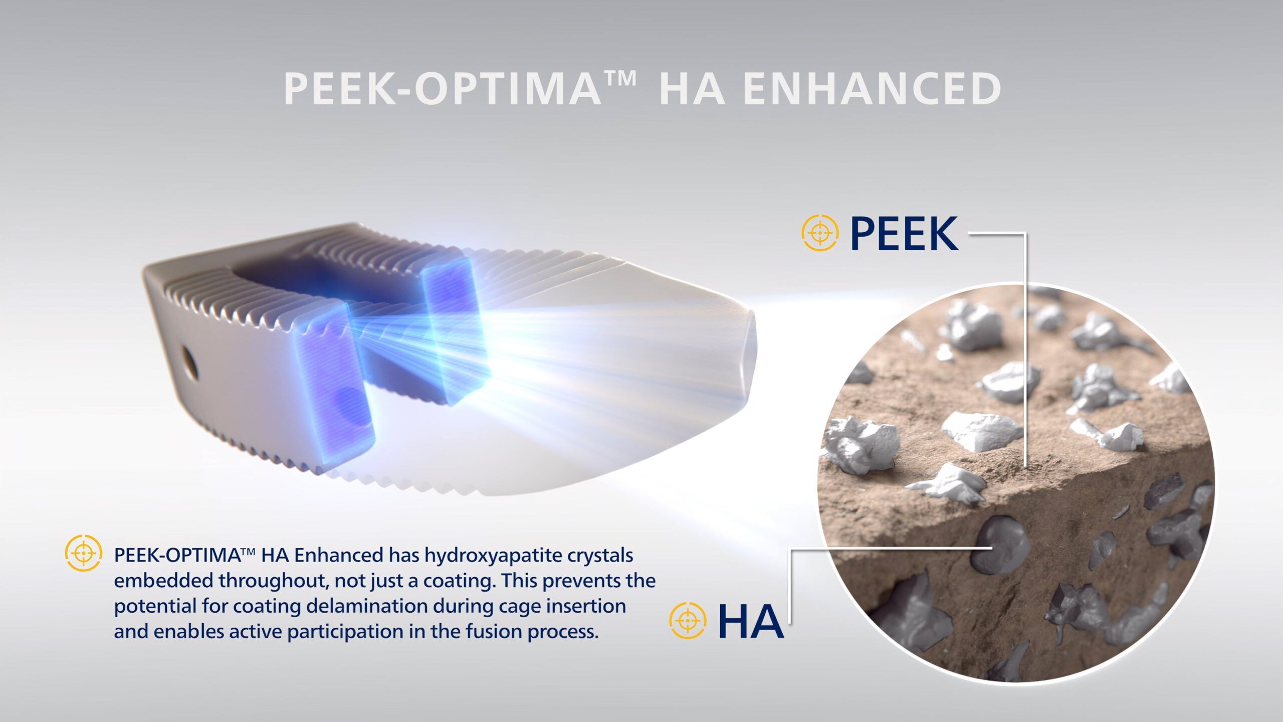 PEEK-OPTIMA HA Enhanced, spinal device technology, hydroxyapatite material enhancement, osteoconductive material, spinal surgeries, patient outcomes, revolutionize, cutting-edge technology, transform, field of spinal medicine.