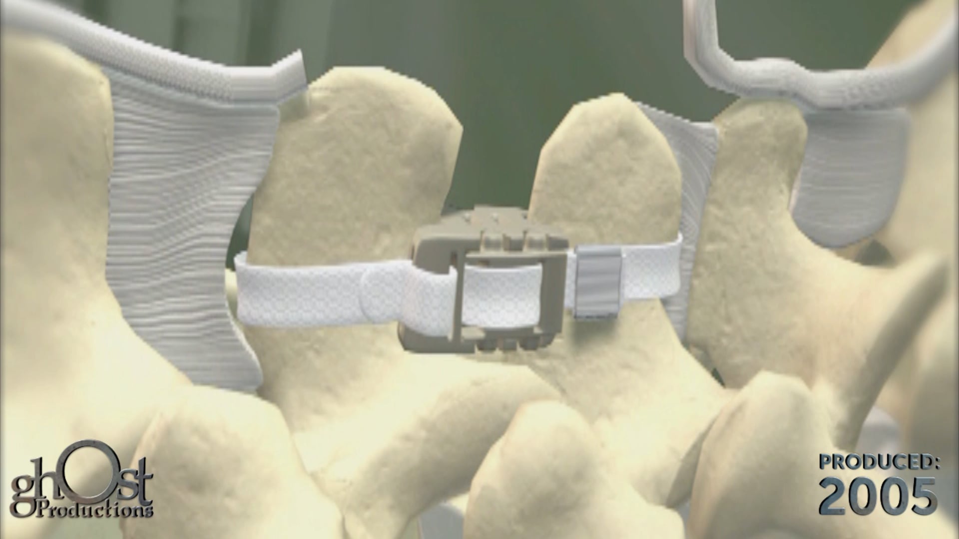 Revolutionizing Medical Animation: The Story of Ghost Medical and Abbott Wallis