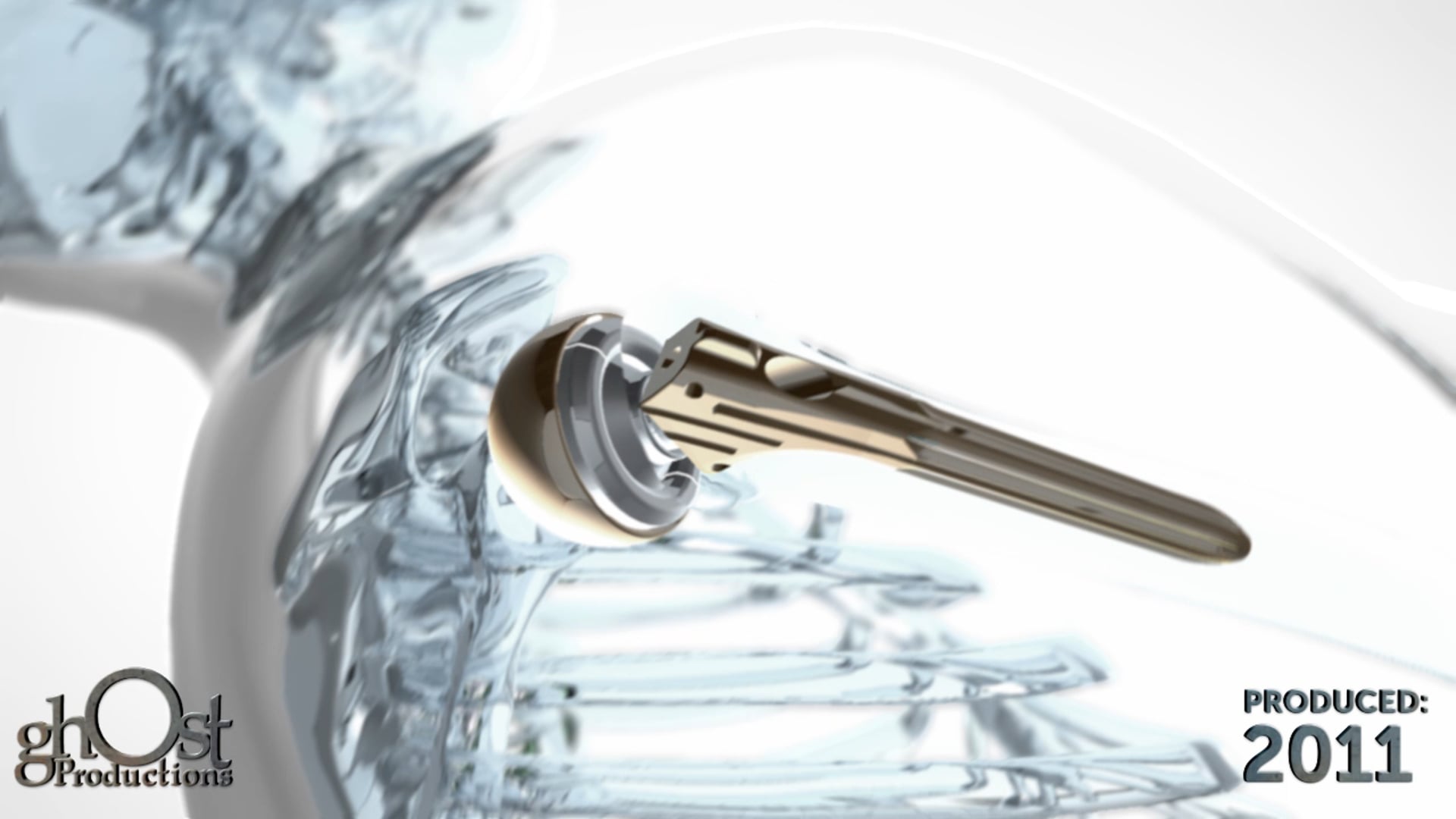 Zimmer Global, Ghost Productions, medical device company, shoulder replacement procedure, visually stunning, medically accurate, anatomy of the shoulder joint, precise placement of the implant, valuable tool, medical professionals, patients, clear understanding, benefits, Glassman anatomy, orthopedic surgeons, innovation, excellence, educating, informing, shoulder replacement options.