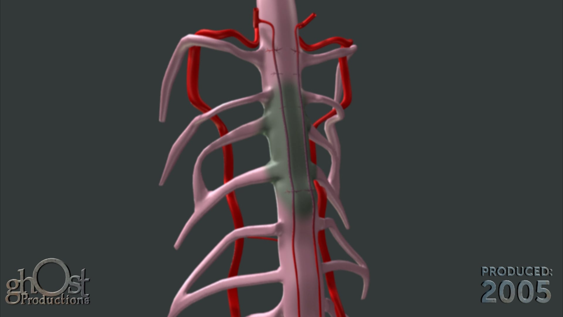 Ghost Productions, medical animation, surgical equipment misuse, visually stunning, medically accurate, permanent paralysis, cautionary tale, medical professionals, safety protocols, impactful visual content, education, information, expertise, commitment, safety practices, protocols, medical field, up-to-date.