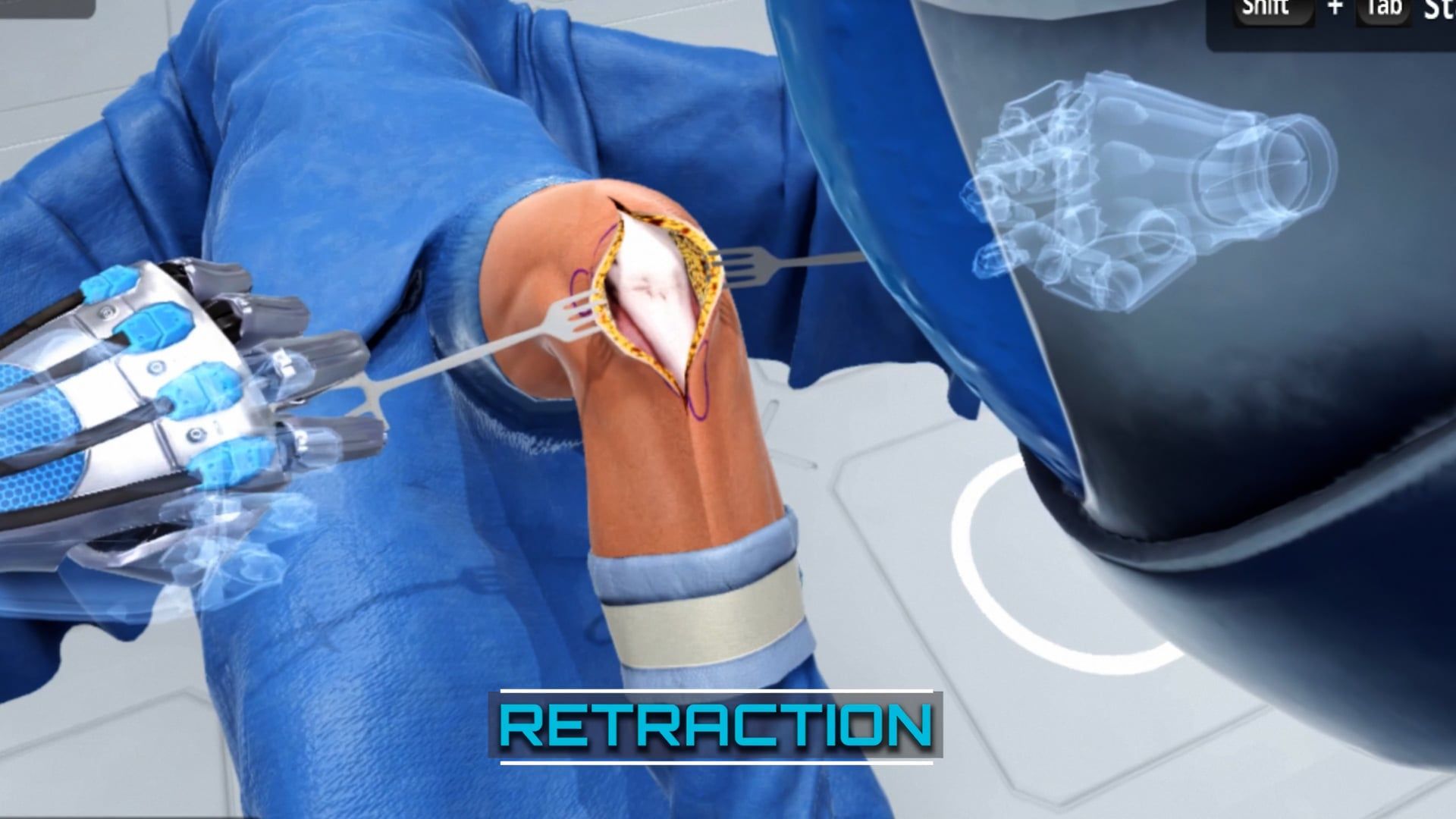 Ghost Productions Medical Animation Studio & Surgical VR Developer offers a cutting-edge solution for medical device sales teams. Their VR surgical simulations allow for accurate and realistic demonstrations of surgical procedures, with all instrumentation, implants, and devices accurately simulated. This technology enables sales reps to conduct demonstrations remotely, providing live training sessions with the entire surgical team. With Ghost Productions, medical device companies can put their products into the hands of more customers than ever before. This innovative approach to medical marketing is sure to increase sales and improve customer satisfaction. Contact Ghost Productions today to learn more about their medical animation and surgical VR services.