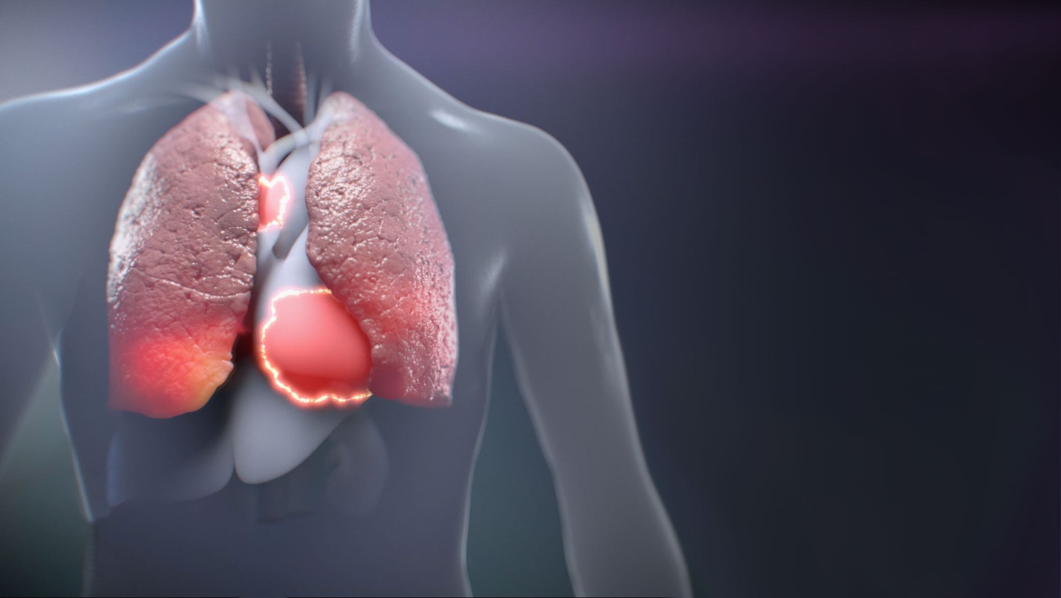 A medical illustration by Ghost Productions depicting the COVID-19 virus. The virus is shown as a sphere with red spikes protruding from its surface. The illustration also includes text describing how the virus is transmitted and how to prevent infection. This educational animation is a valuable resource for learning about COVID-19 and staying safe during the pandemic.