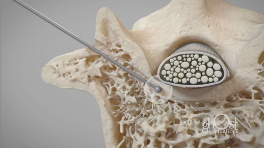 Animation demonstrating Depuy Synthes Sentio Nerve Mapping System with advanced pedicle screw and retractor systems for spinal procedures. Provides real-time feedback on nerve location to enhance precision and safety. Shows seamless integration of technologies and benefits of the system.