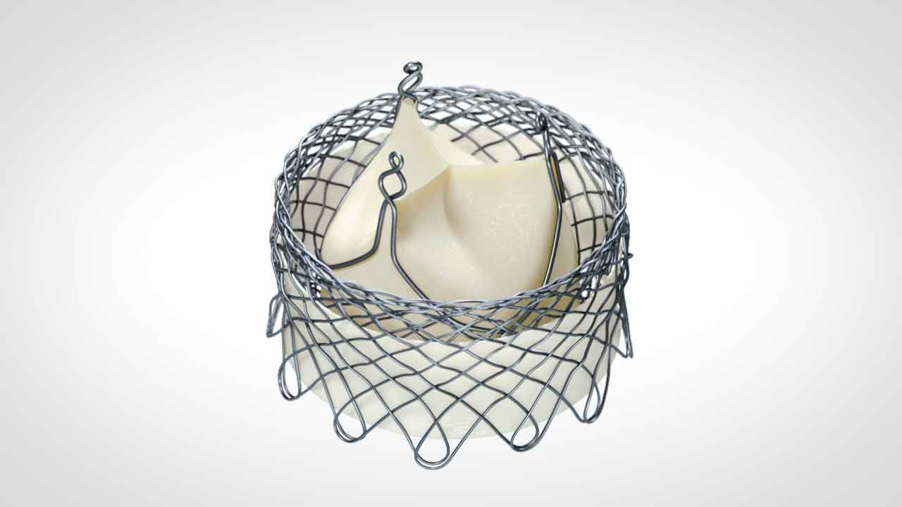 Animation of the Meridian Valve Implantation procedure using the HLT TAVR Device. Provides a step-by-step guide to implanting the Meridian Valve, including crossing the diseased aortic valve, positioning the self-expanding support structure in the annulus, inverting the valve, and exposing the tissue leaflets for valve function. Designed to restore normal blood flow across the diseased aortic valve and reduce symptoms of the disease.