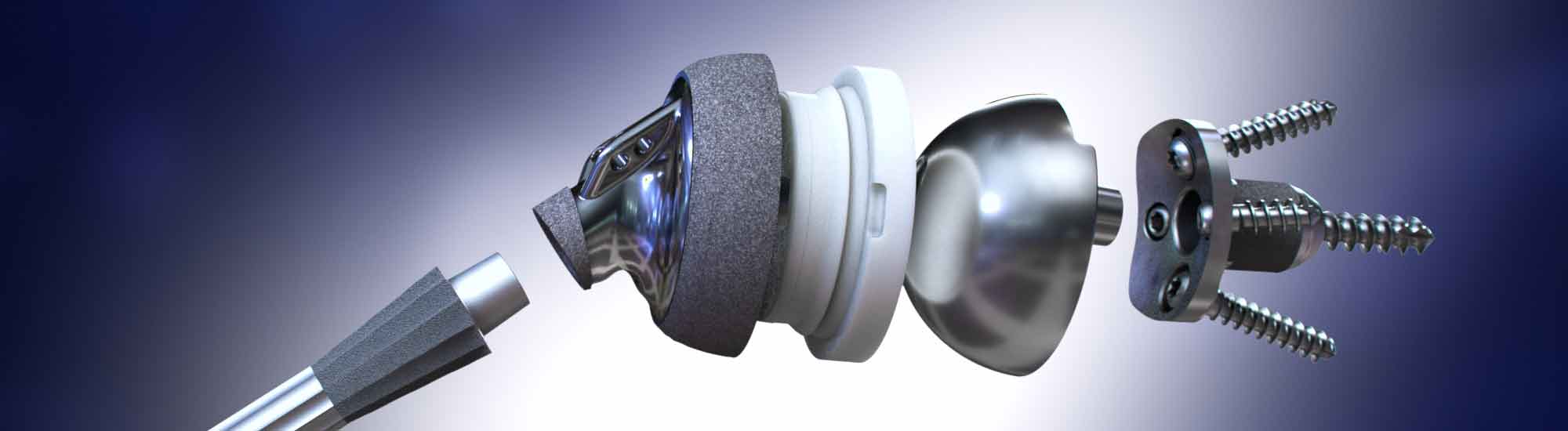 Integra Life Sciences' medical illustration showcases their advanced Shoulder Plates, including Modular, Reverse, and Proximal Humeral Plating Systems. These systems offer customized options to provide superior support and stability for shoulder injuries. Whether you need maximum flexibility with a modular approach, improved range of motion with a reverse shoulder system, or enhanced strength with a proximal humeral plating system, Integra Life Sciences has a solution for you. Trust their expertise and experience to help you achieve optimal outcomes and return to an active lifestyle.